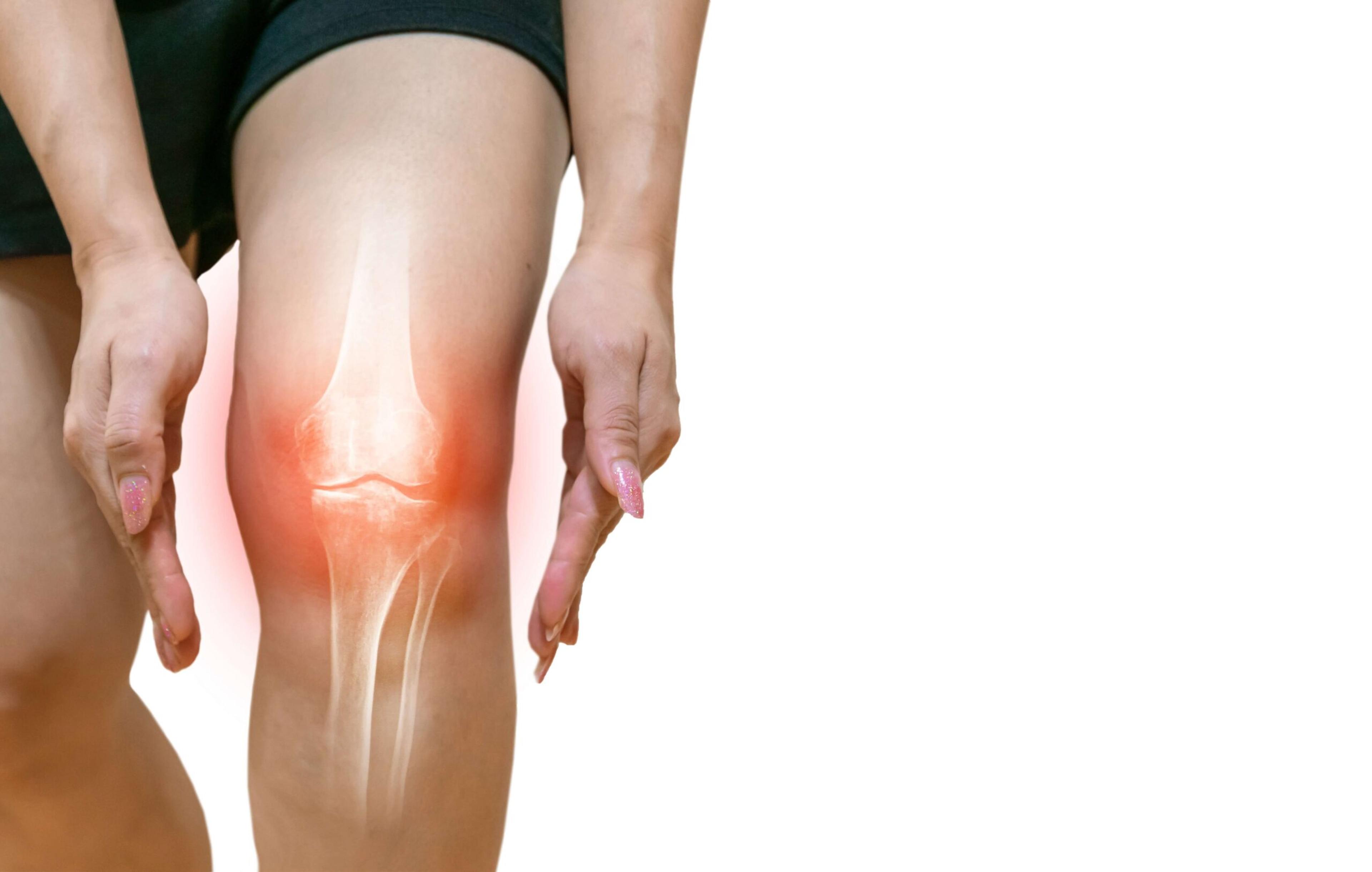 Lesões do joelho: tratamentos e cirúrgicos disponíveis