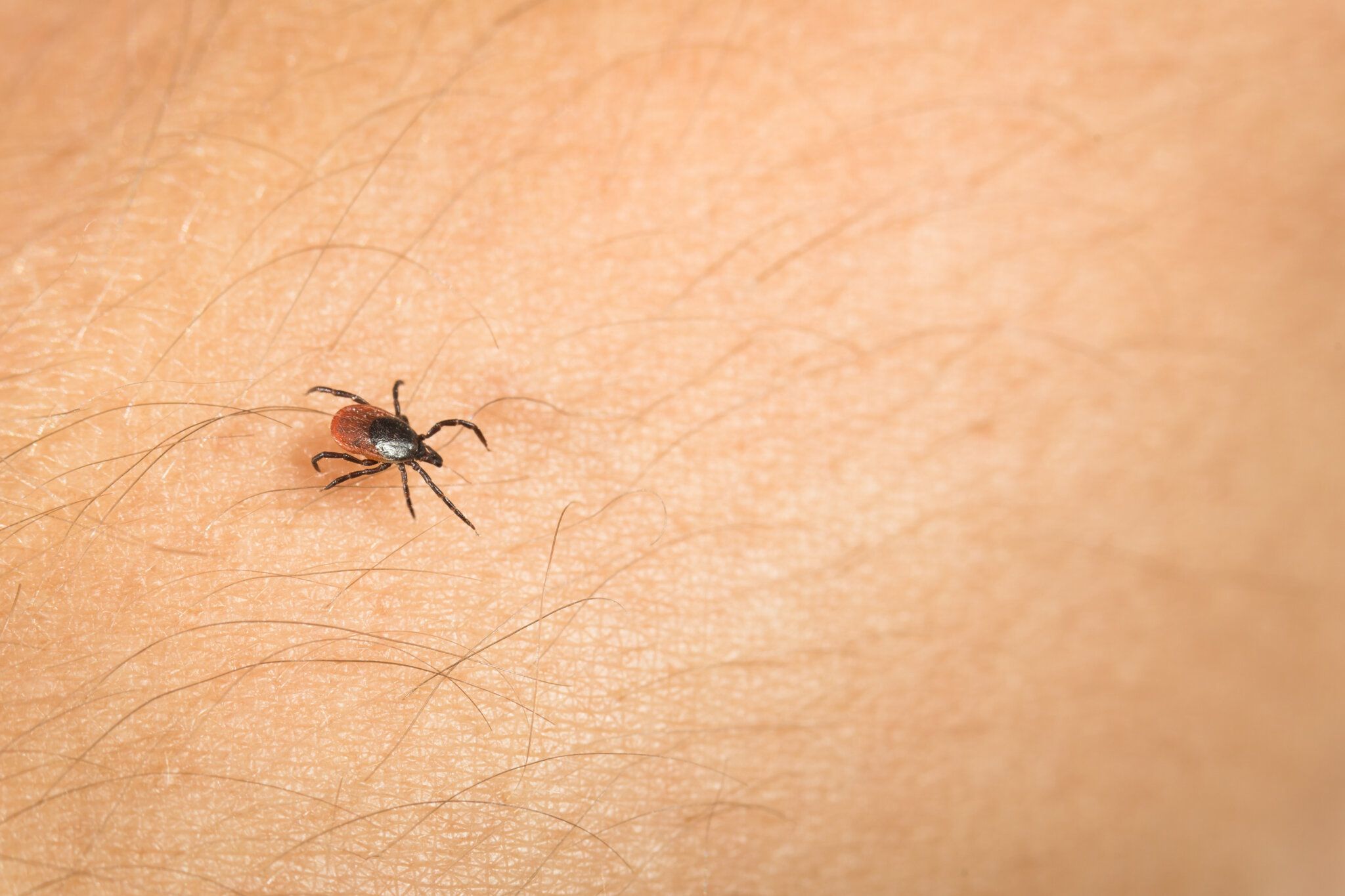 One of the 5 Common spring Pest is Deer Tick On Skin