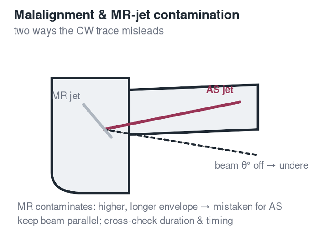 Doppler beam malalignment and MR-jet contamination of the AS signal