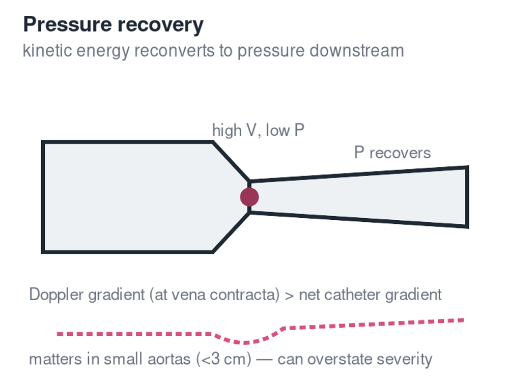 Pressure recovery: kinetic-to-potential energy conversion in the ascending aorta
