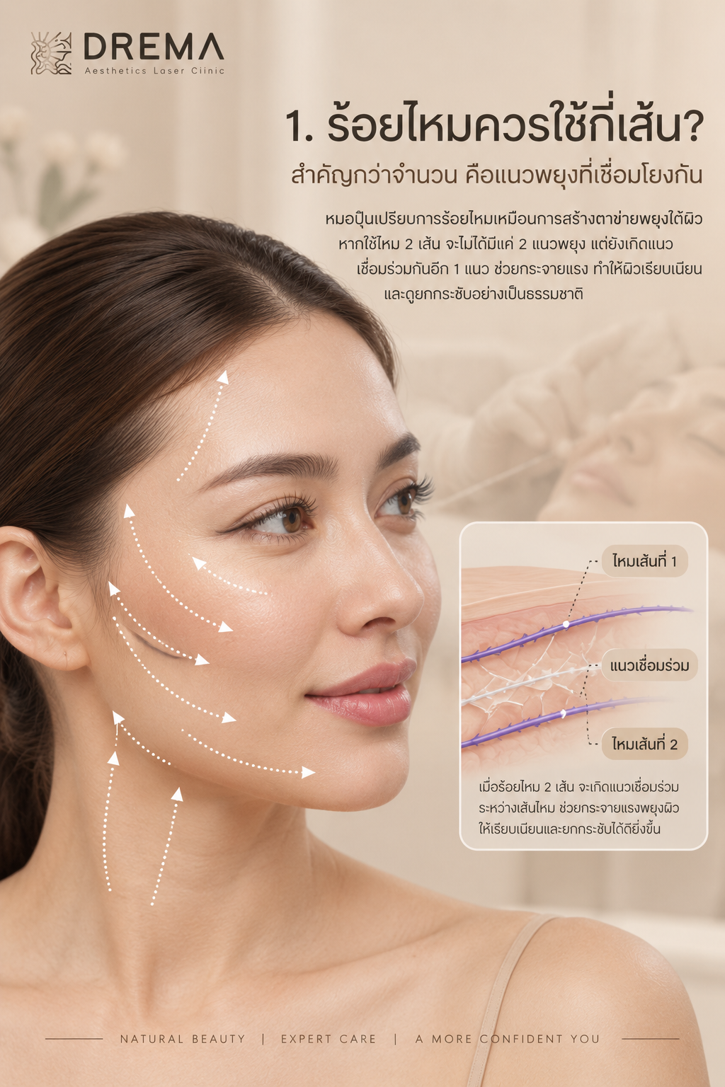 ร้อยไหมควรใช้กี่เส้น