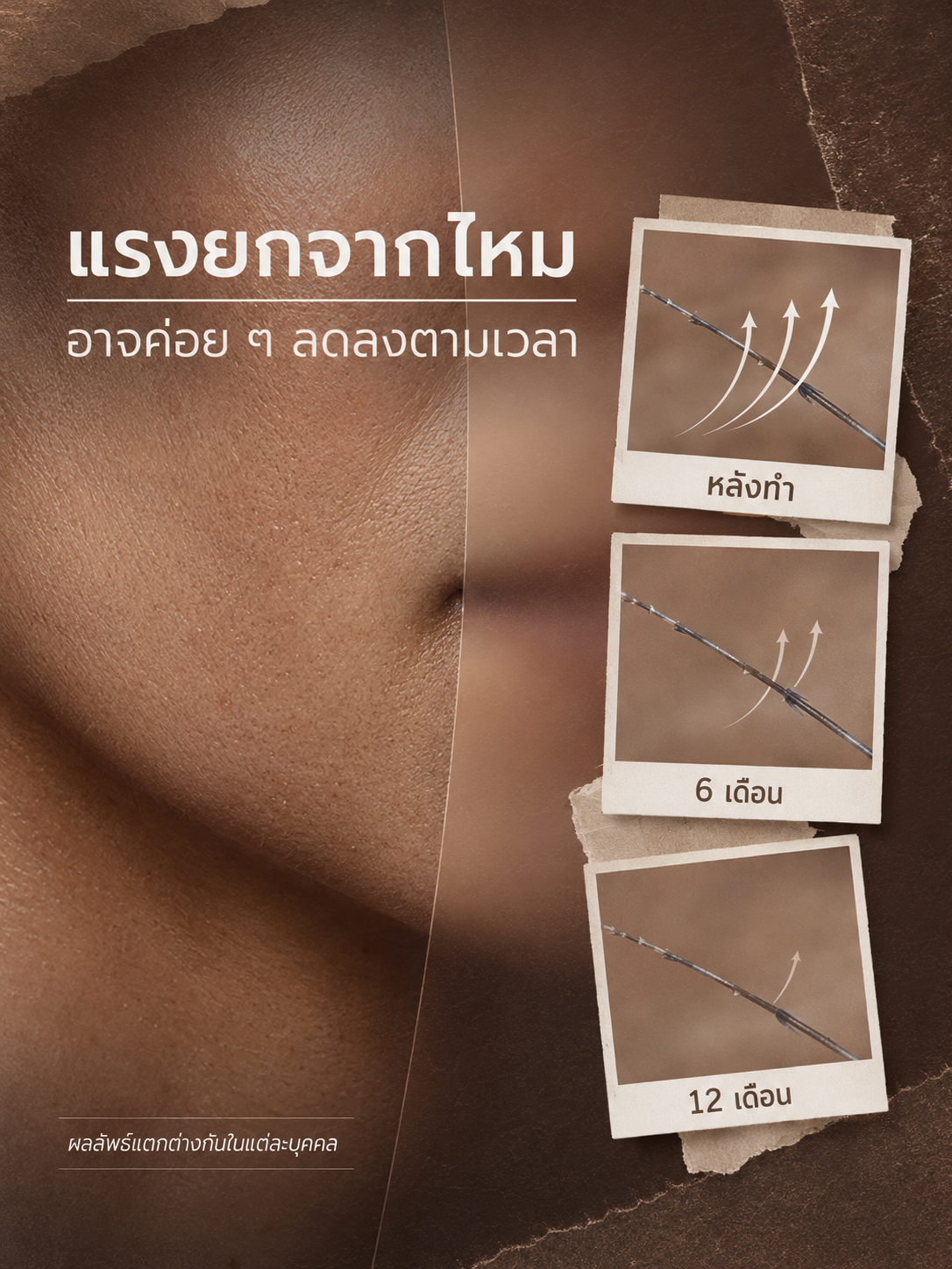 แรงยกของไหม