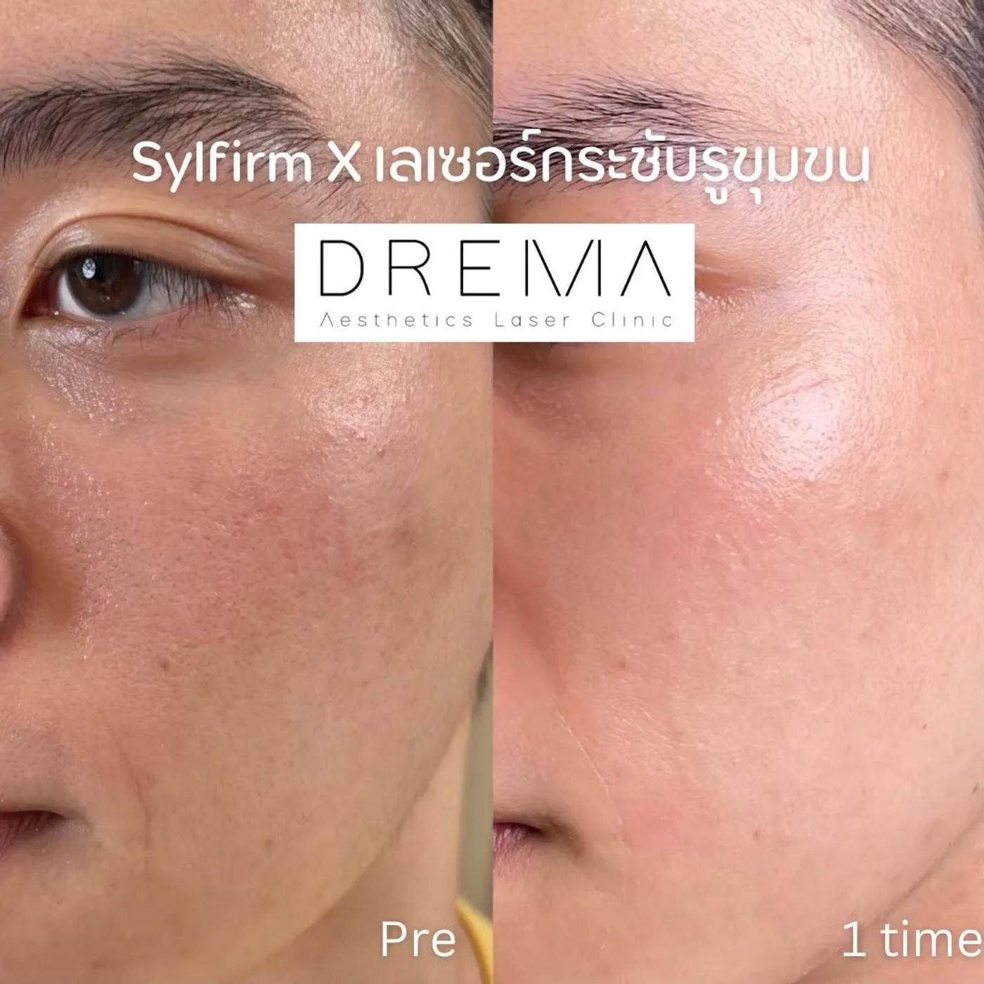 รีวิว SYLFIRM X 27
