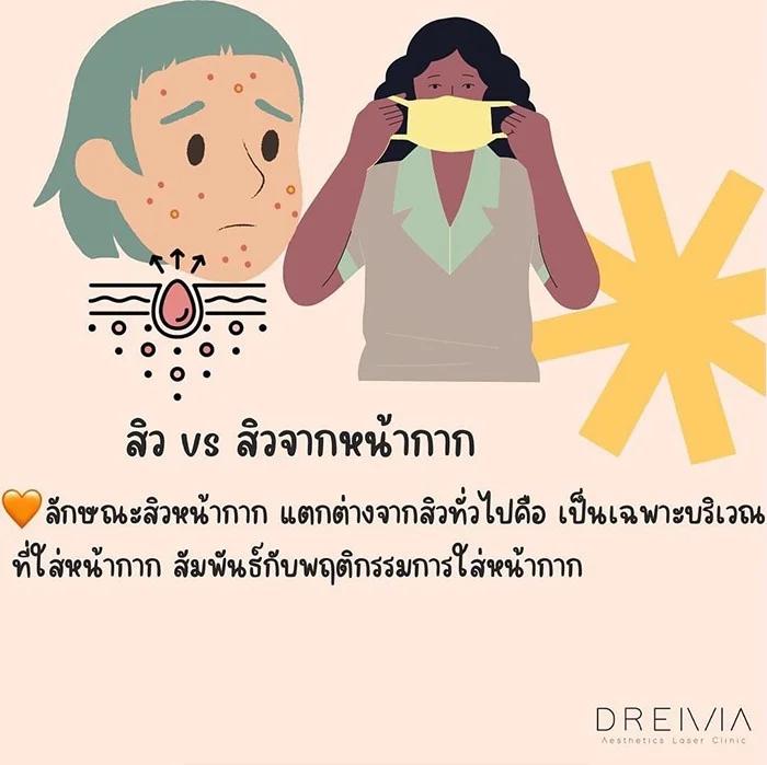 Maskne ( สิวจากหน้ากาก)