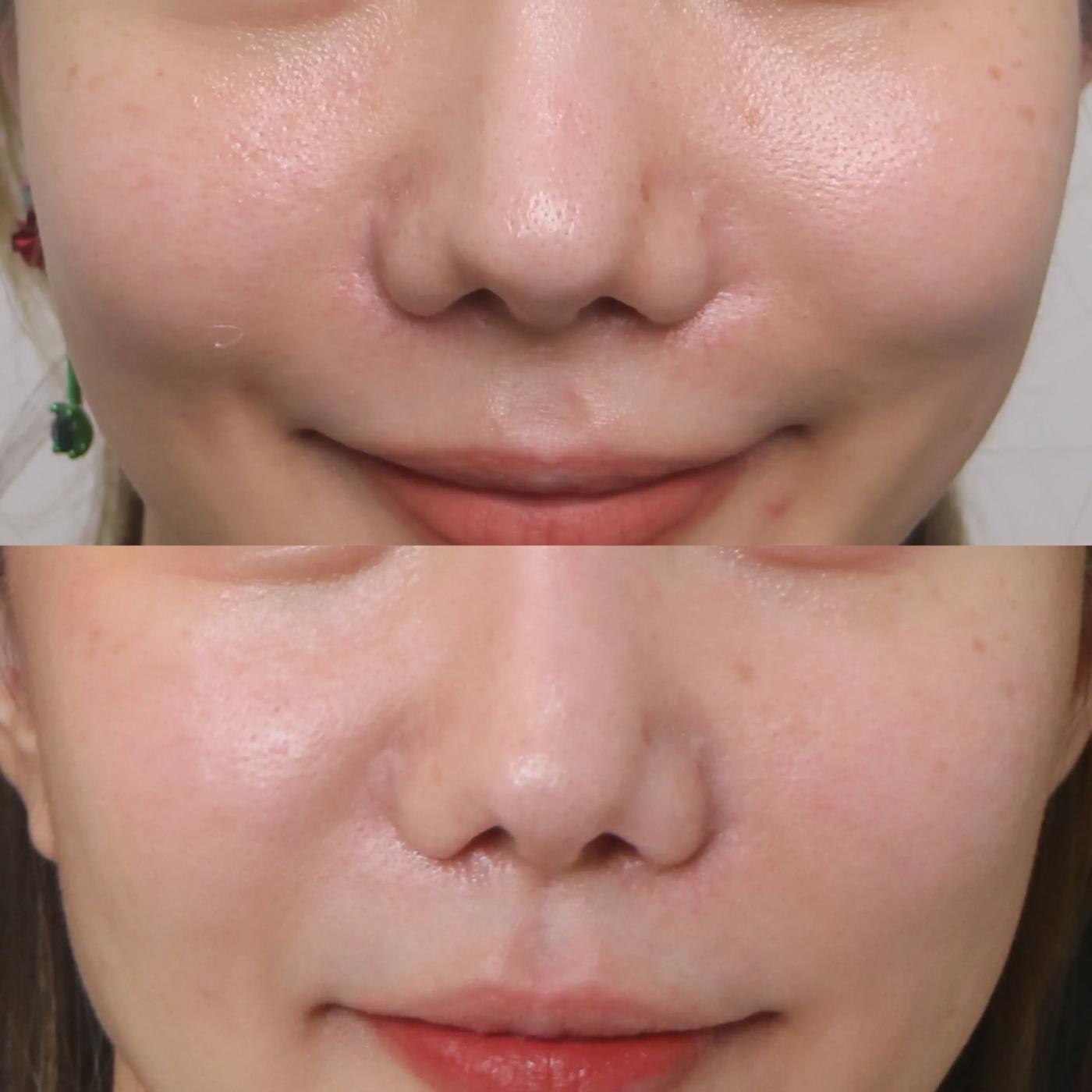 รีวิว SYLFIRM X 2