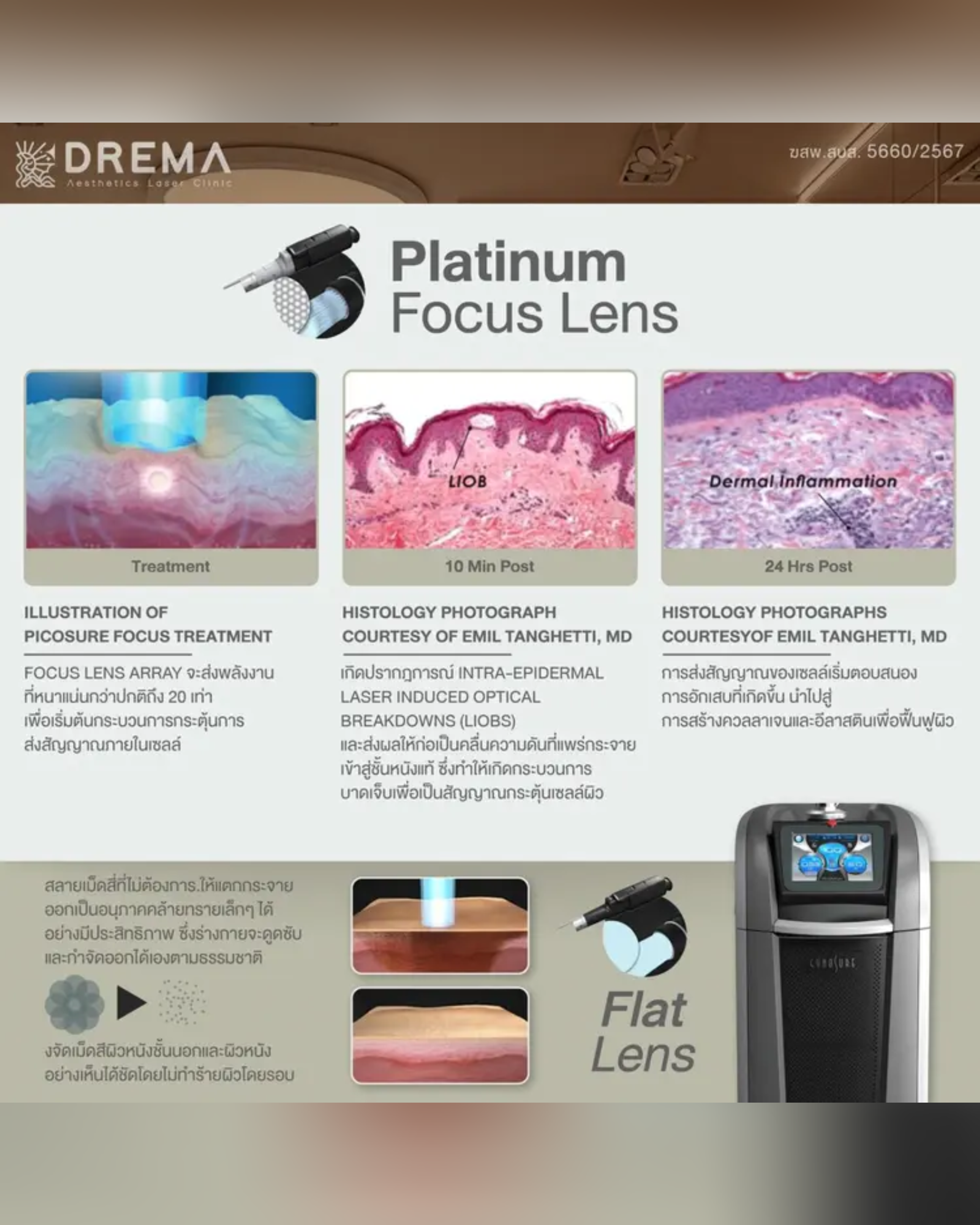 ทำความรู้จัก PicoSure Laser คืออะไร ช่วยเรื่องอะไร มีข้อดี-ข้อเสียยังไง