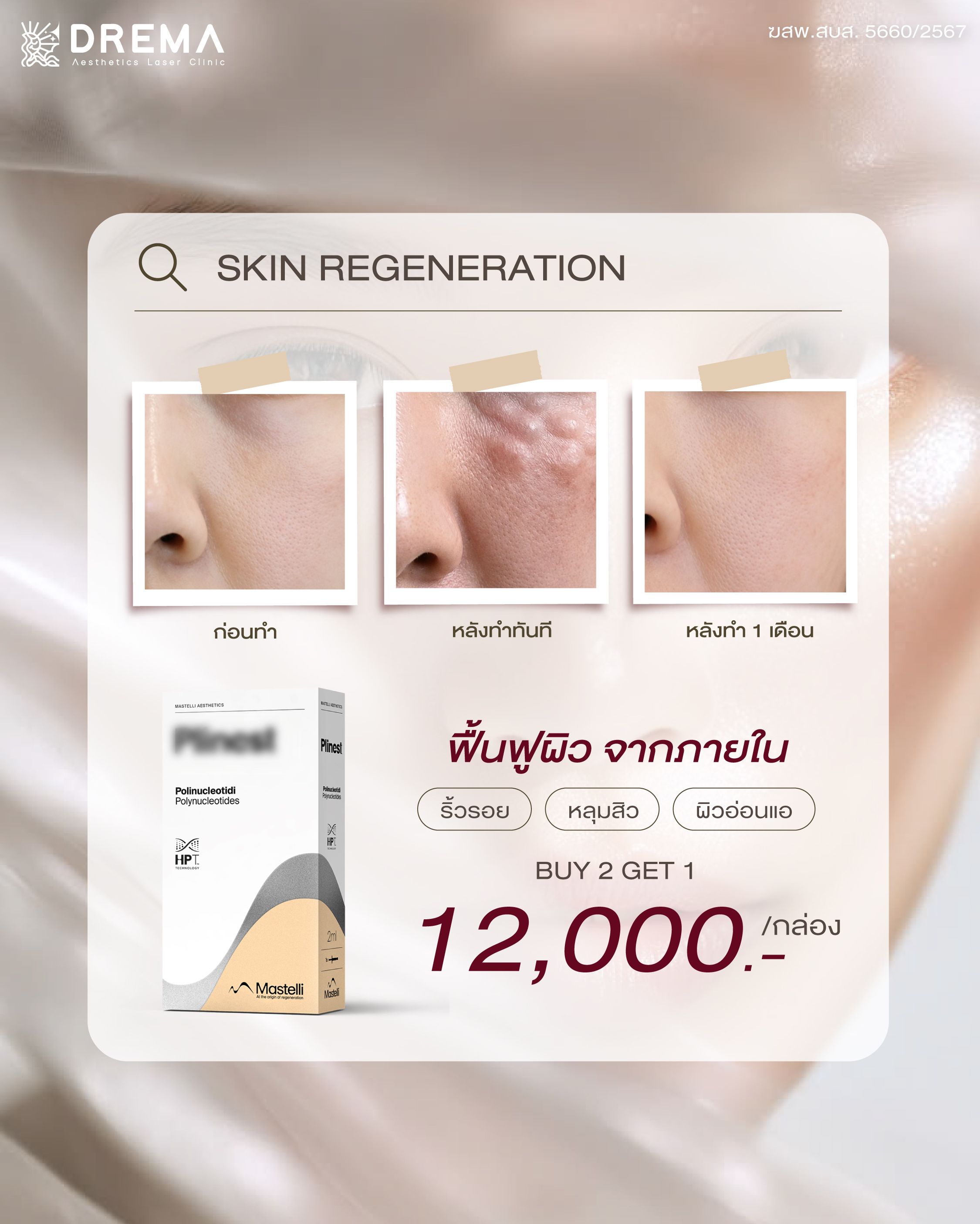 ภาพหลังทำ