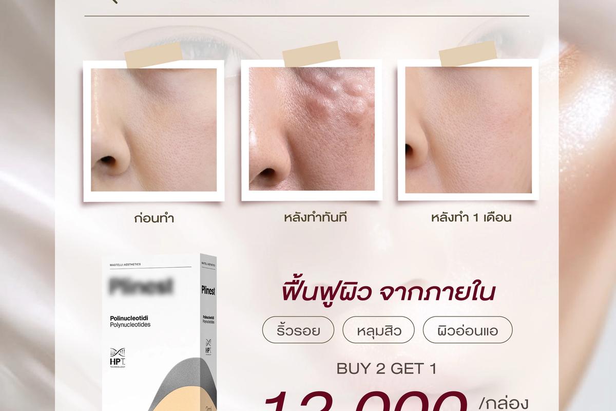 ภาพหลังทำ