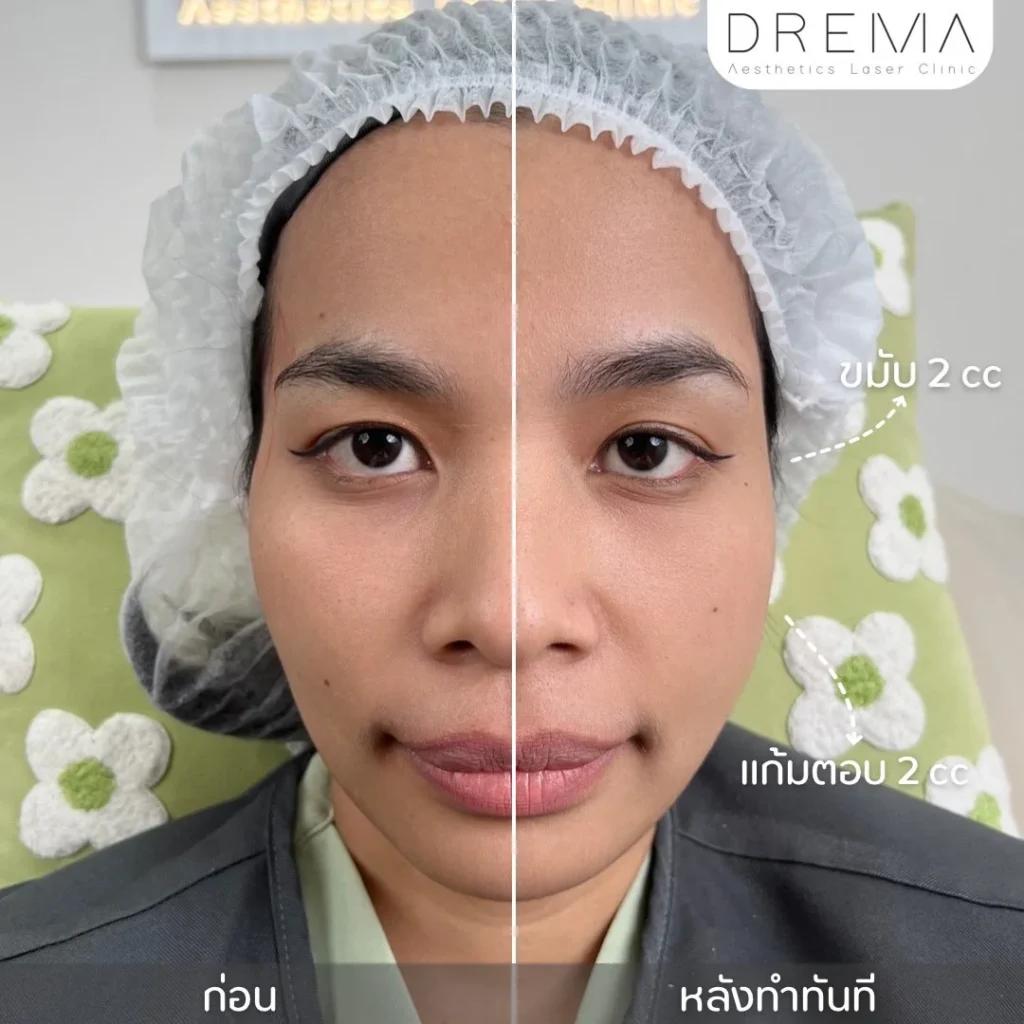 แก้มตอบ
