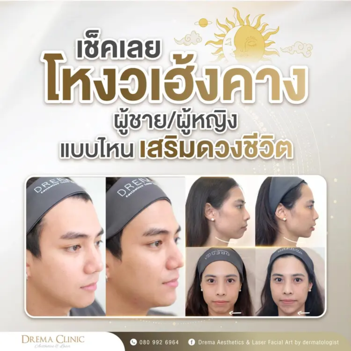 physiognomy-chin - Drema Clinic