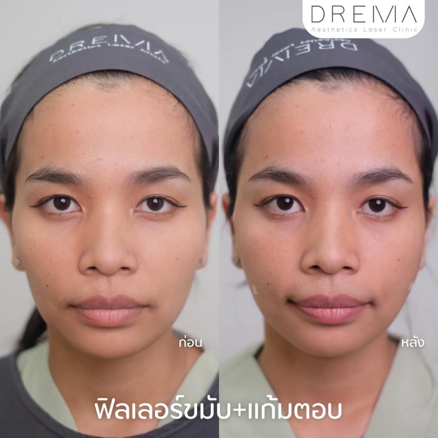 temp-filler - Drema Clinic