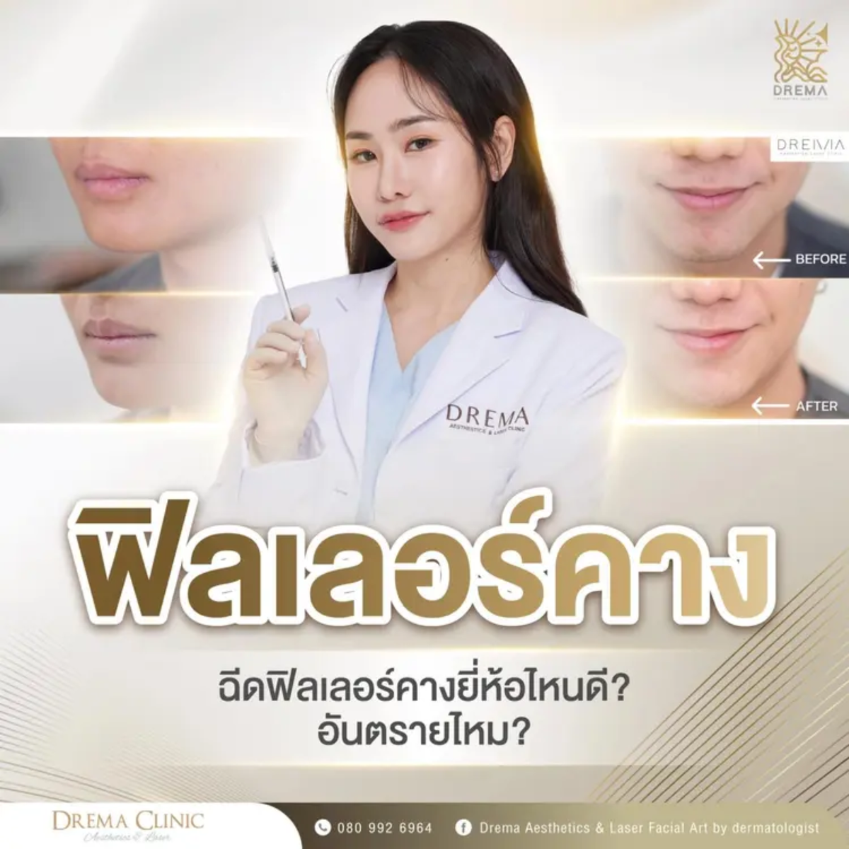 chin-filler - Drema Clinic