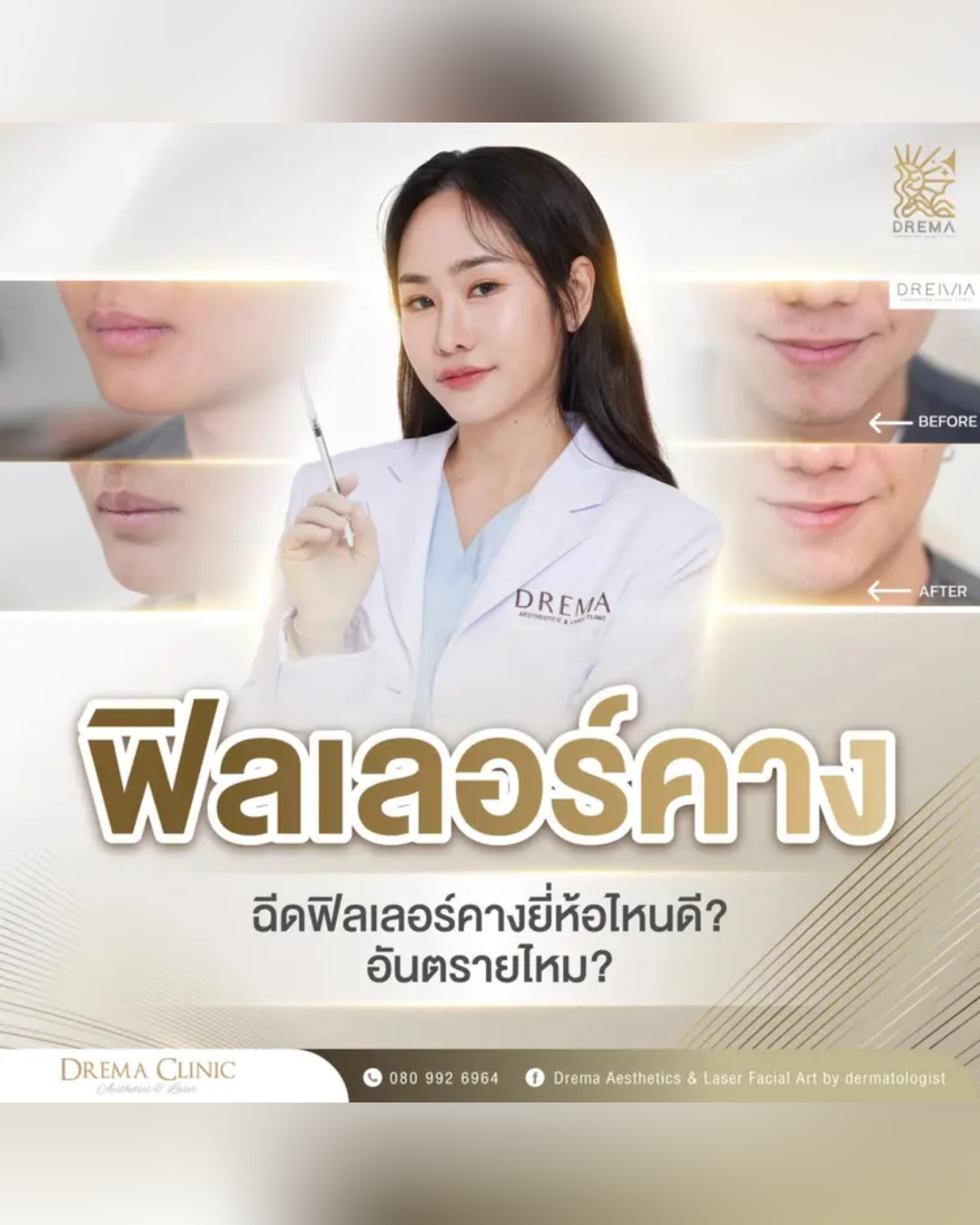 chin-filler - Drema Clinic