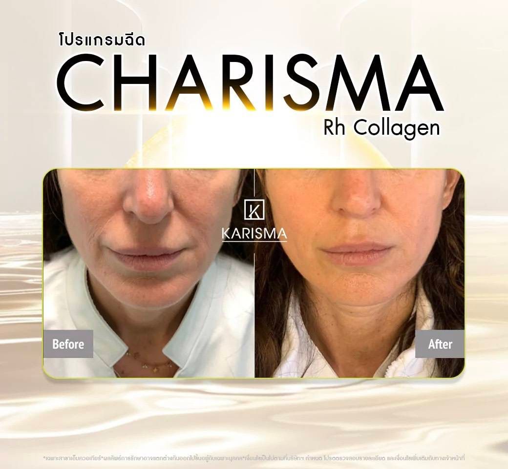 รูปรีวิว Skin Booster Drema Clinic เคสที่ 9