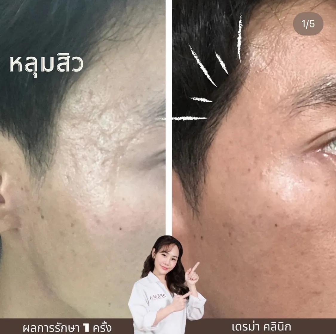 รีวิว SYLFIRM X 16