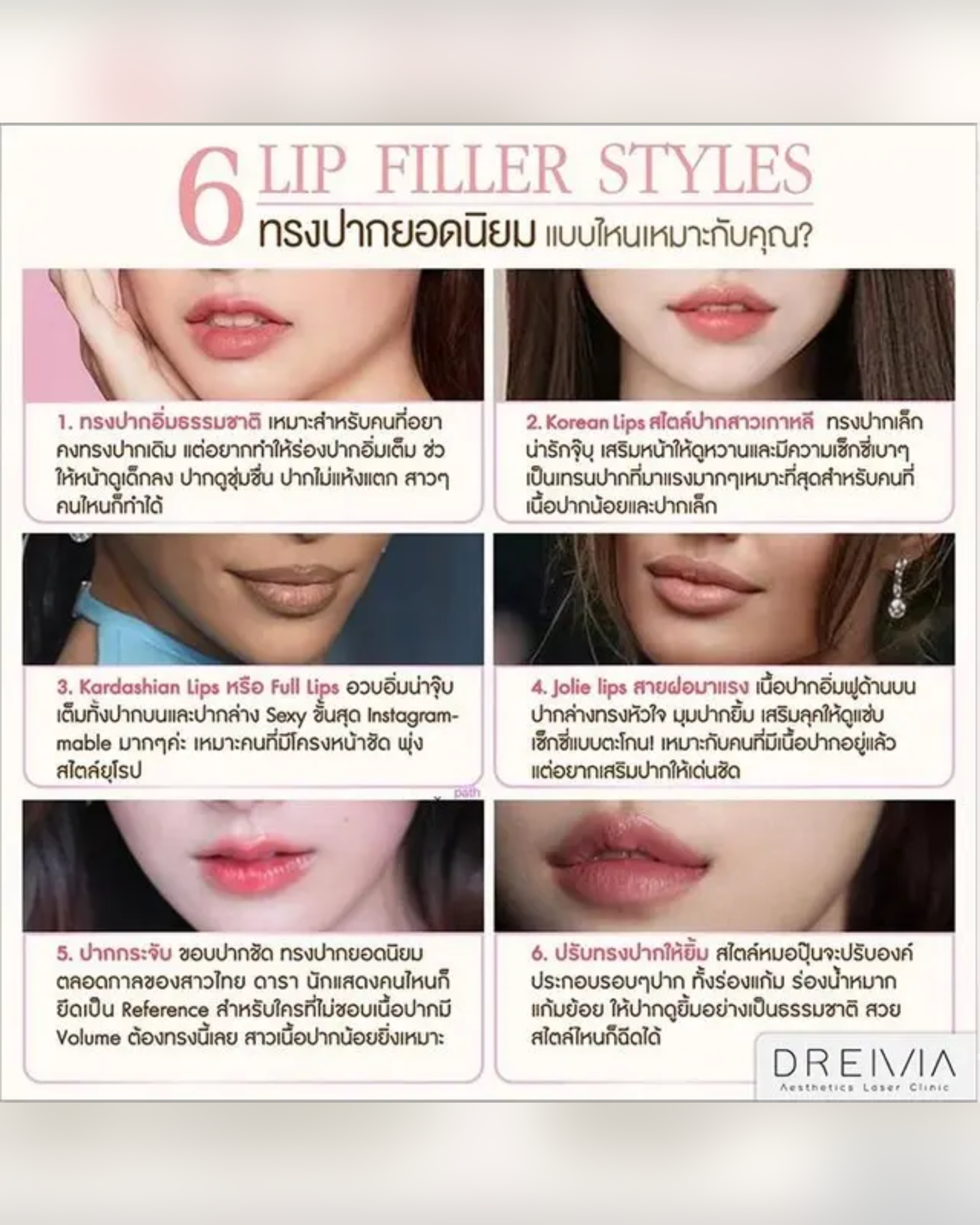 most-popular-lip-shapes - Drema Clinic