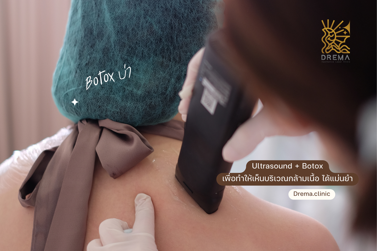 Botox บ่า