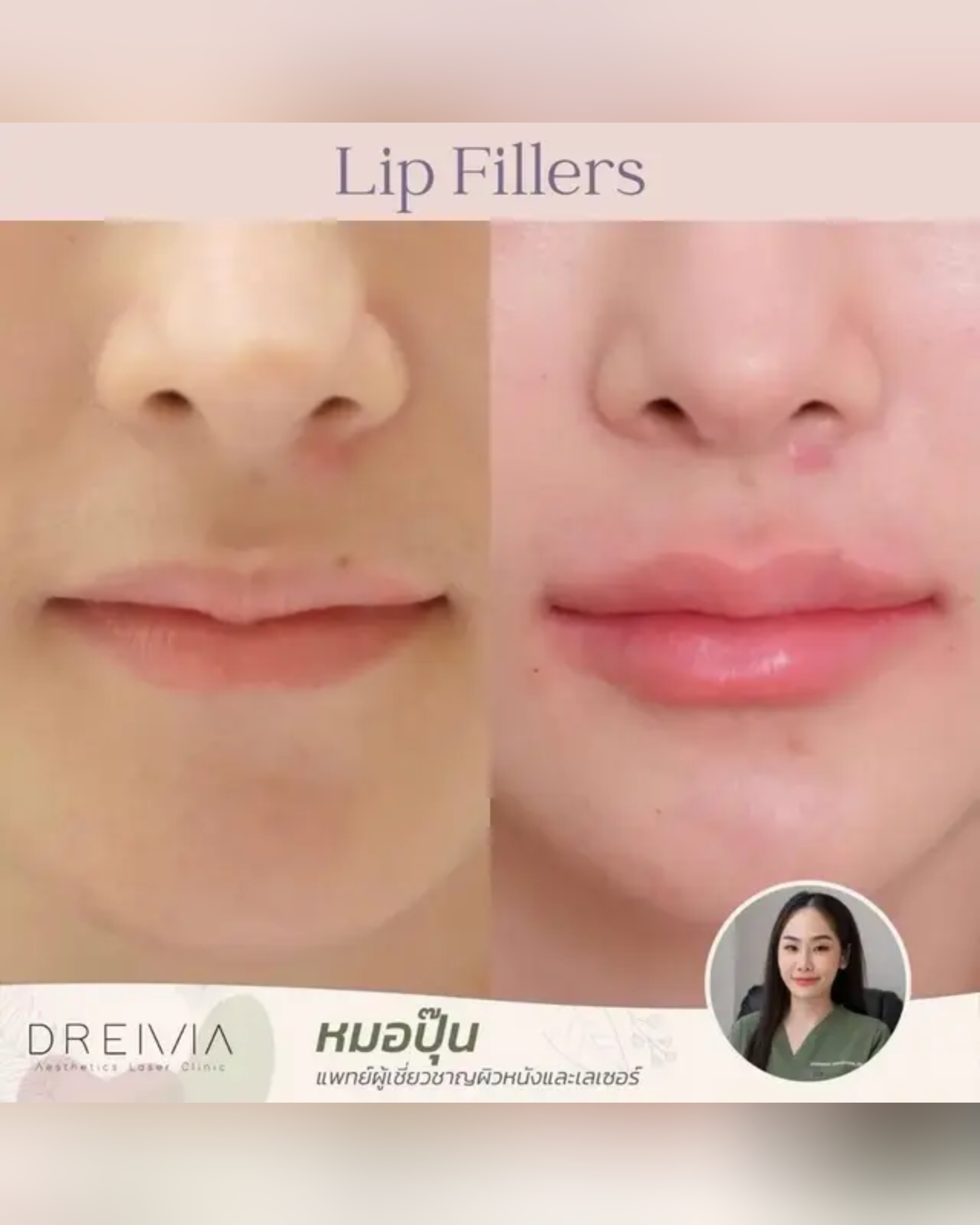 filler-sleep-guide - Drema Clinic