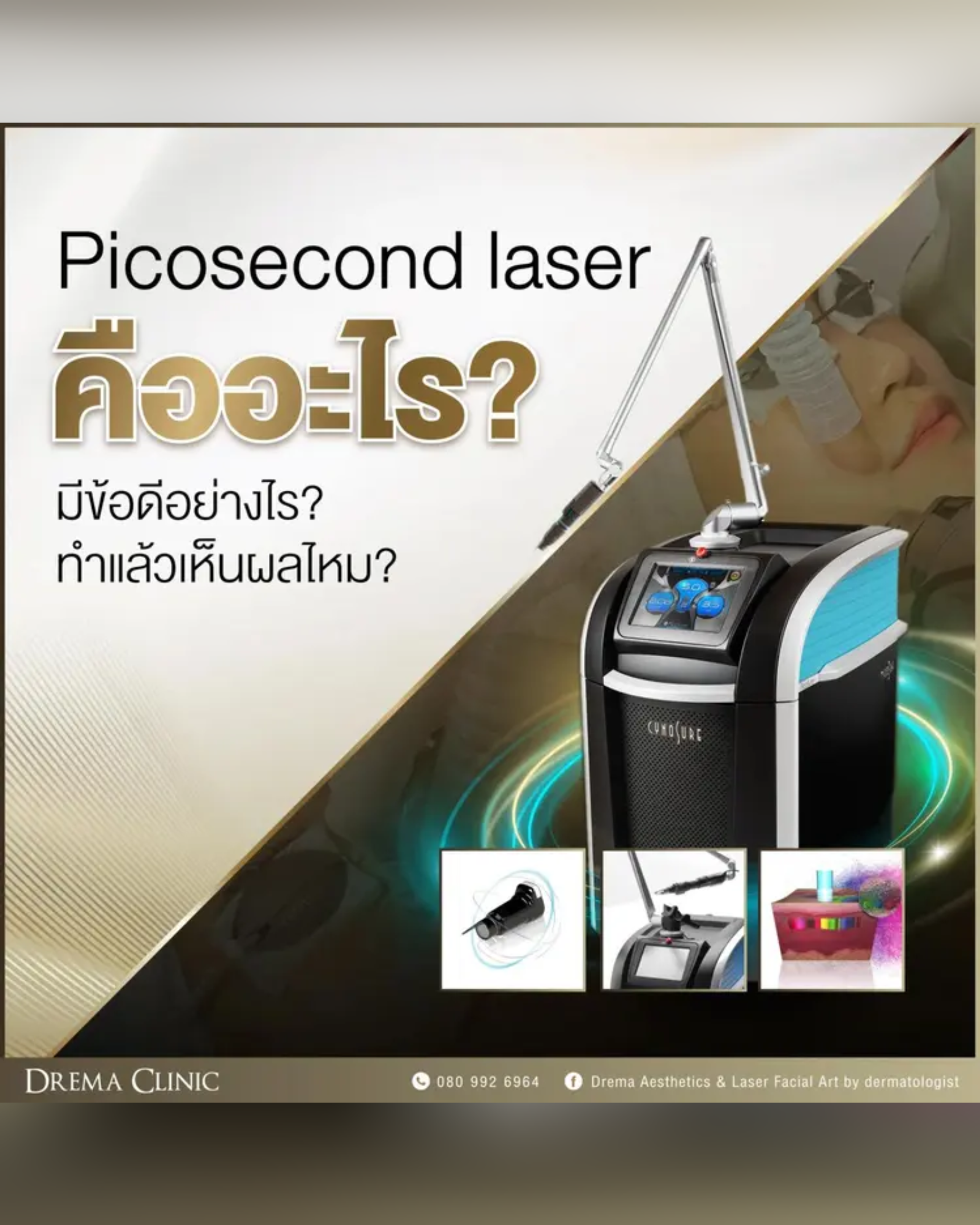 สรุปให้แล้ว Picosecond laser คืออะไร มีข้อดีอย่างไร ทำแล้วเห็นผลไหม