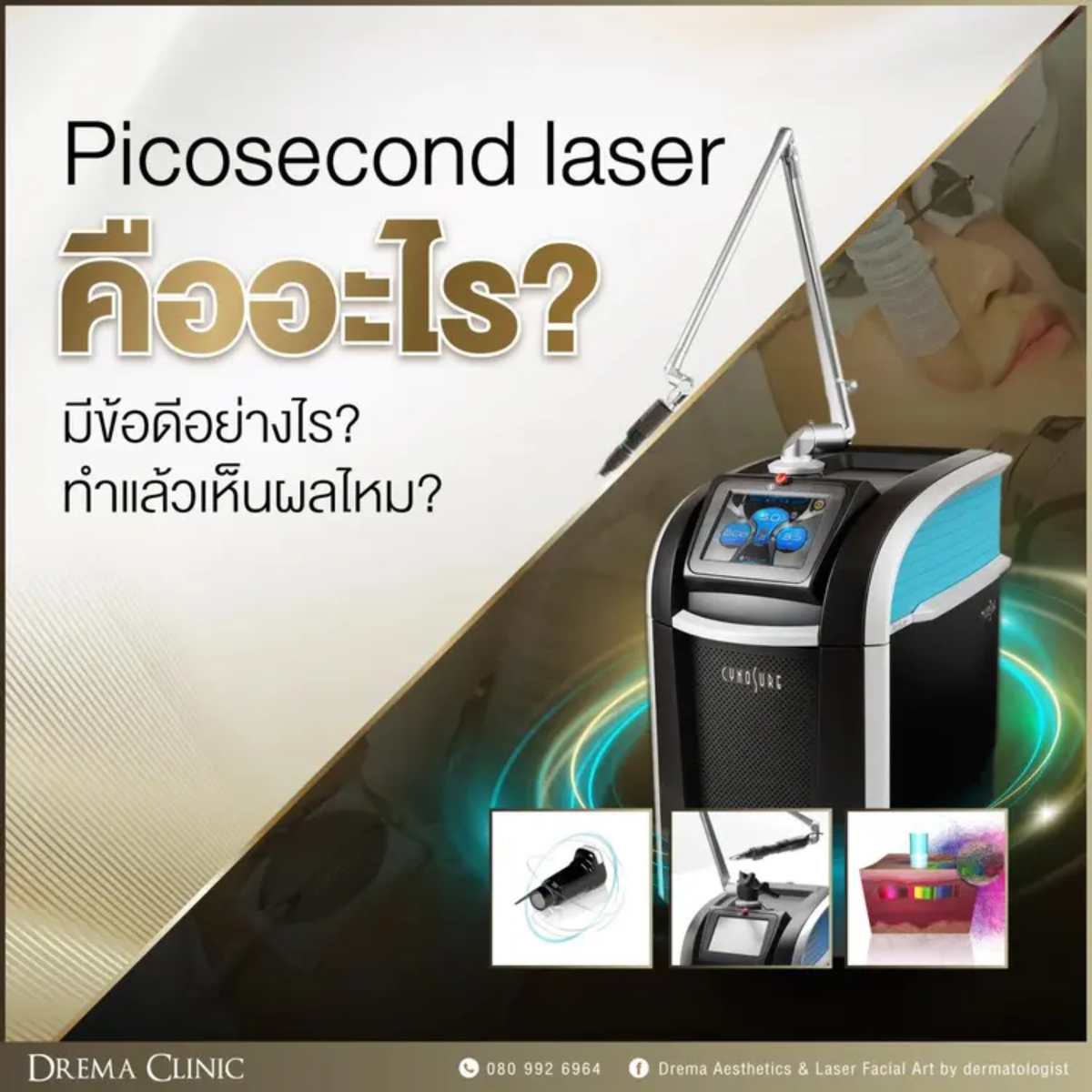 สรุปให้แล้ว Picosecond laser คืออะไร มีข้อดีอย่างไร ทำแล้วเห็นผลไหม