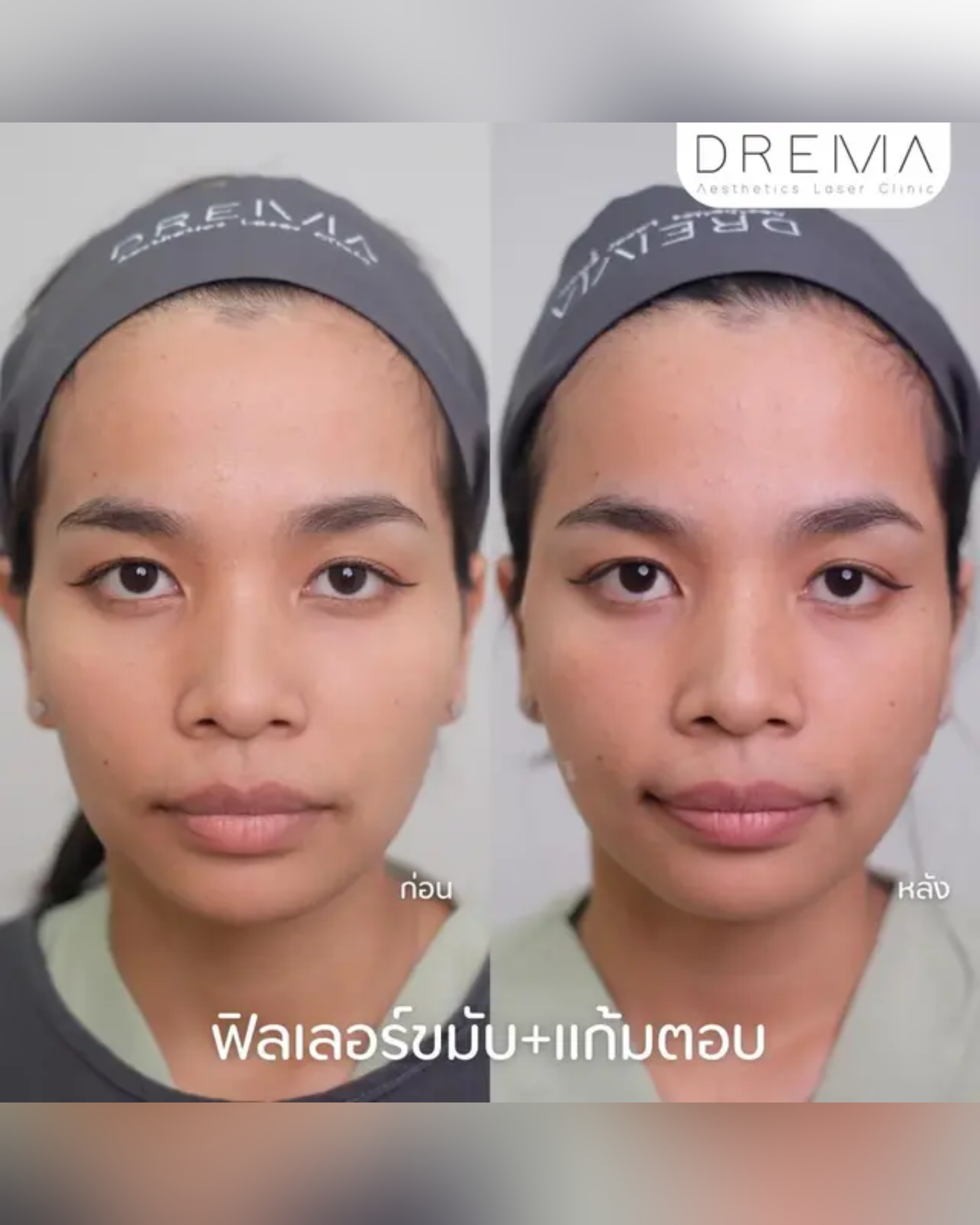 temp-filler - Drema Clinic