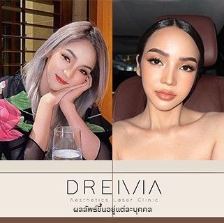 รีวิว Filler ปาก 49