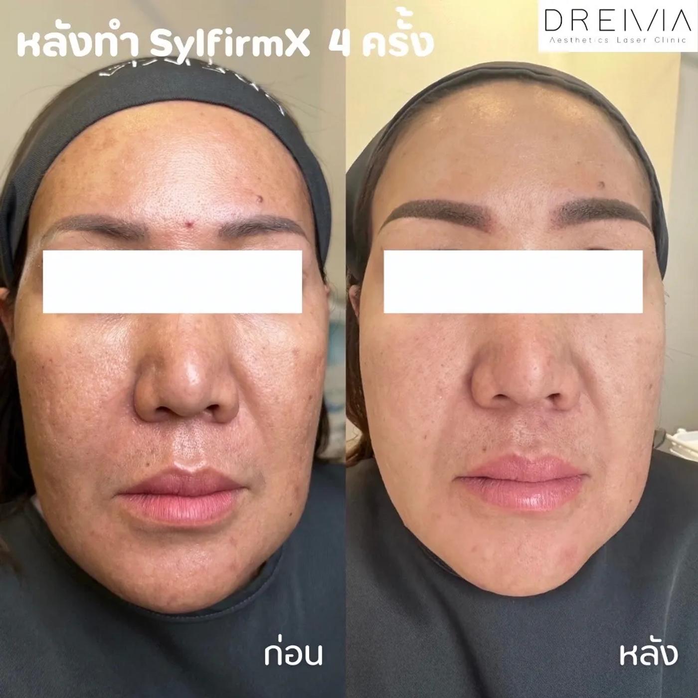 รีวิว SYLFIRM X 14