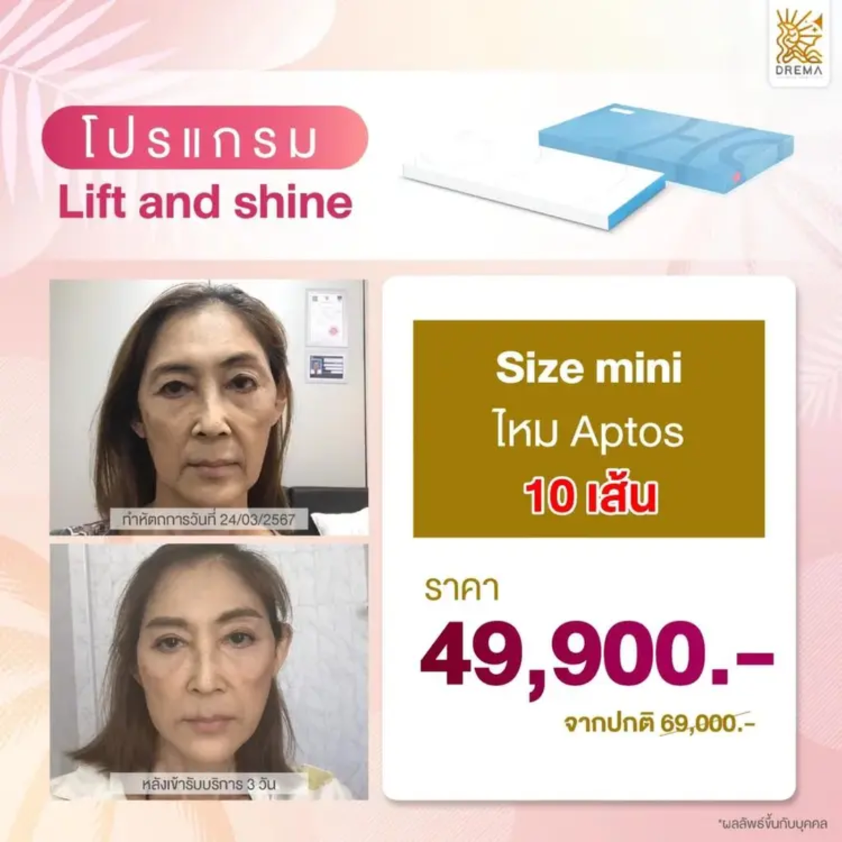 รวมมาให้แล้ว ร้อยไหม คืออะไร อันตรายไหม อัพเดตล่าสุดฉบับปี 2567 - Drema Clinic