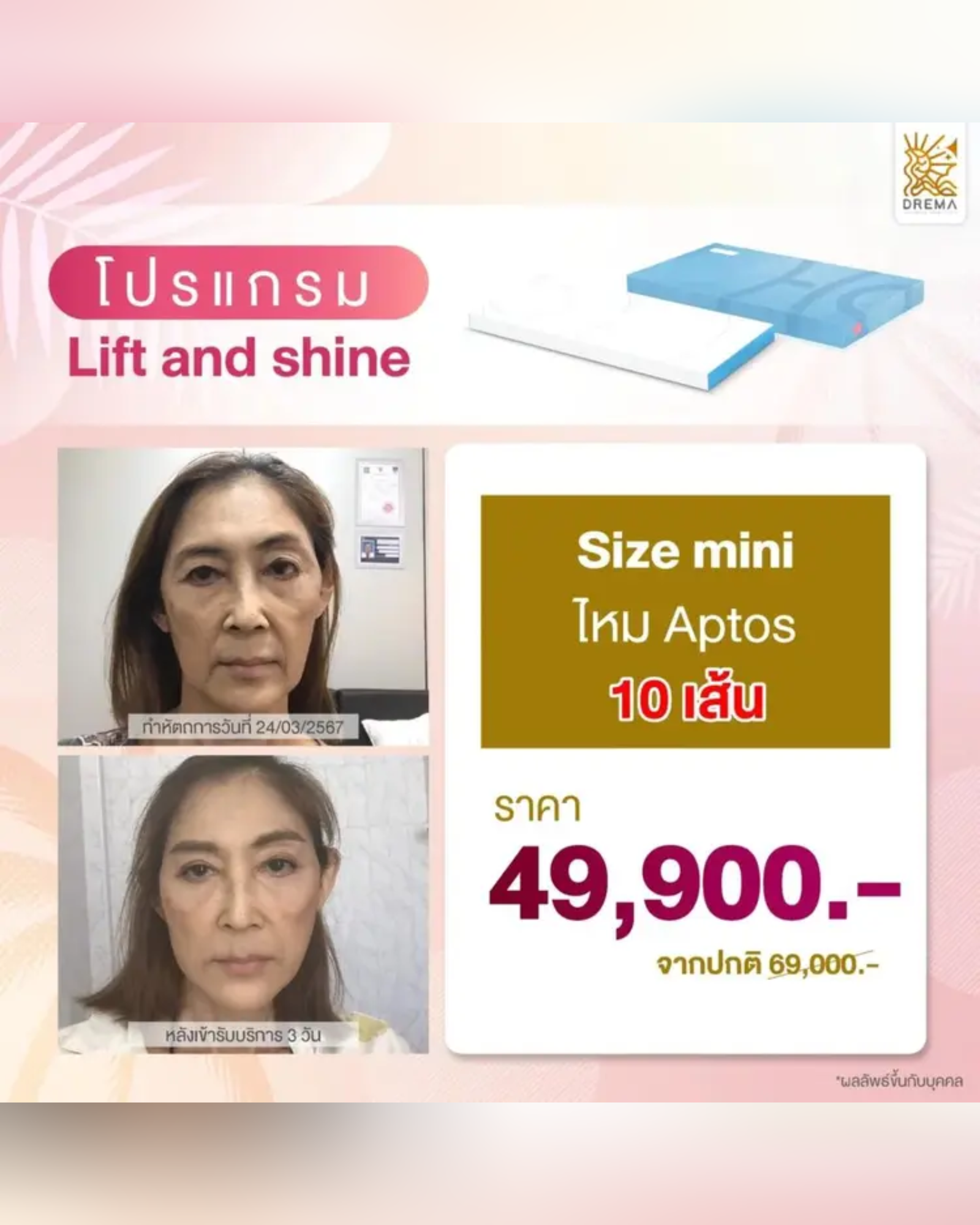 รวมมาให้แล้ว ร้อยไหม คืออะไร อันตรายไหม อัพเดตล่าสุดฉบับปี 2567 - Drema Clinic