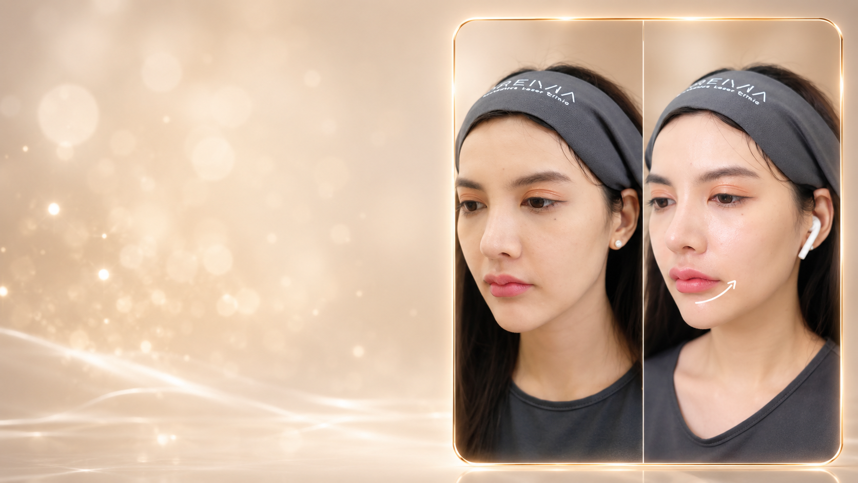 review-filler-lip
