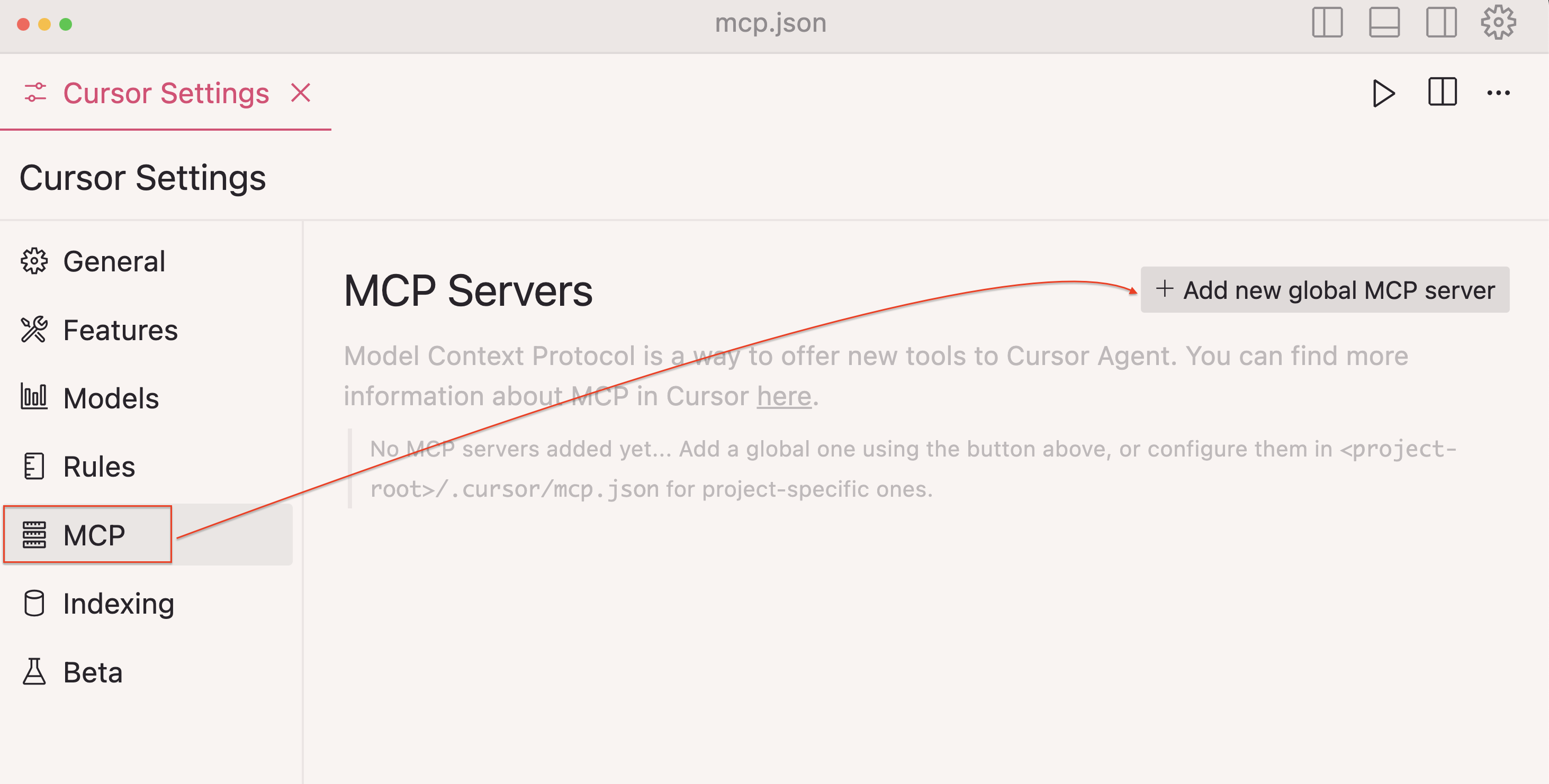 mcp-configuration-screen