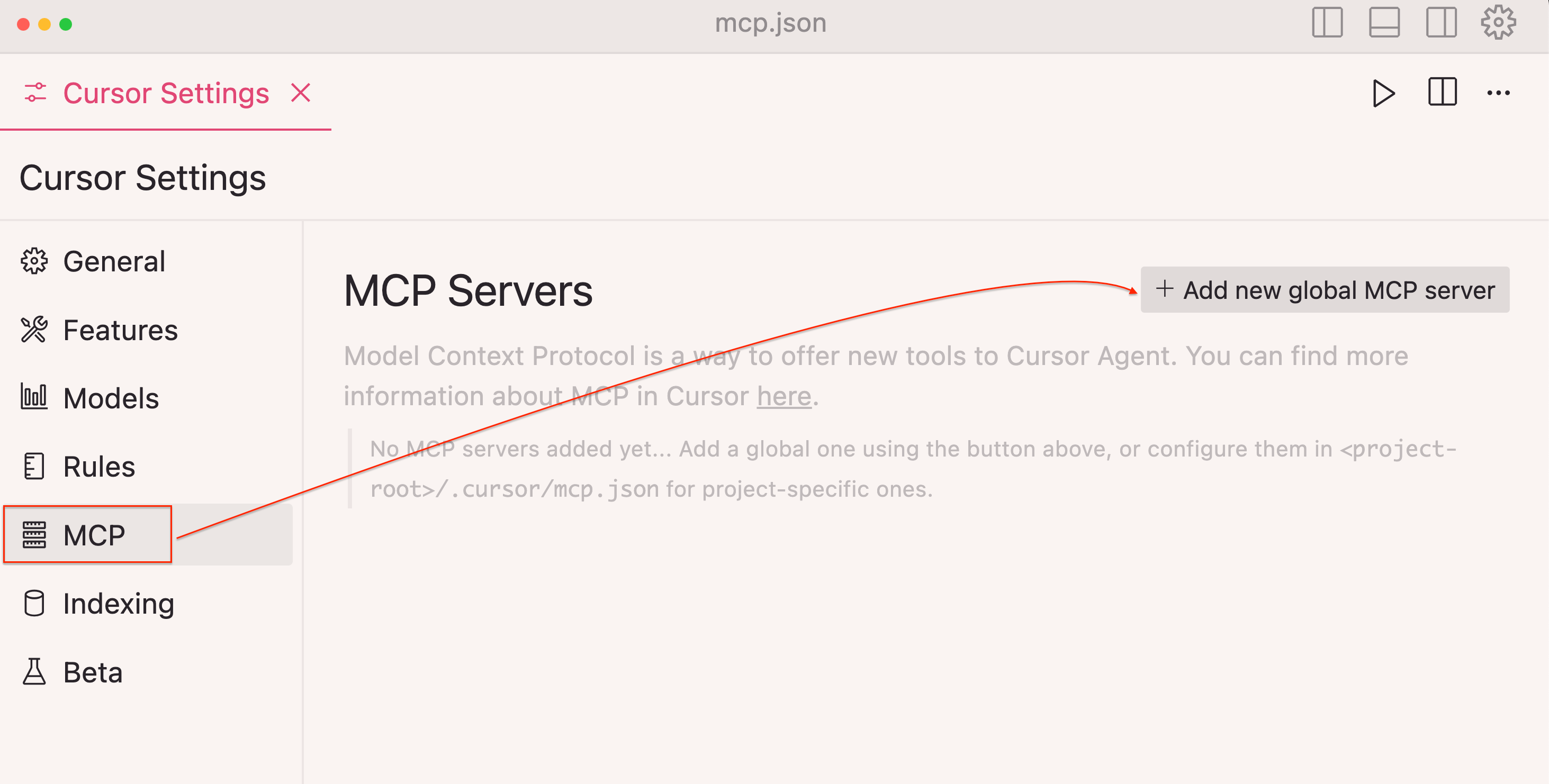 mcp-configuration-screen