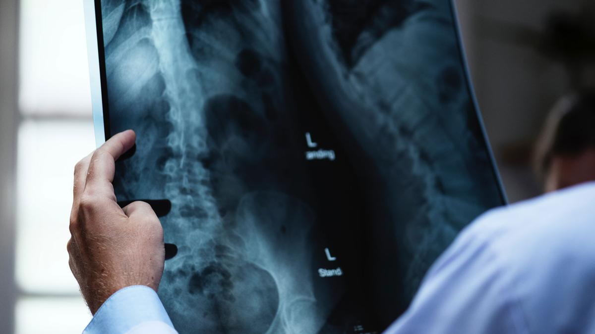 lung_cancer