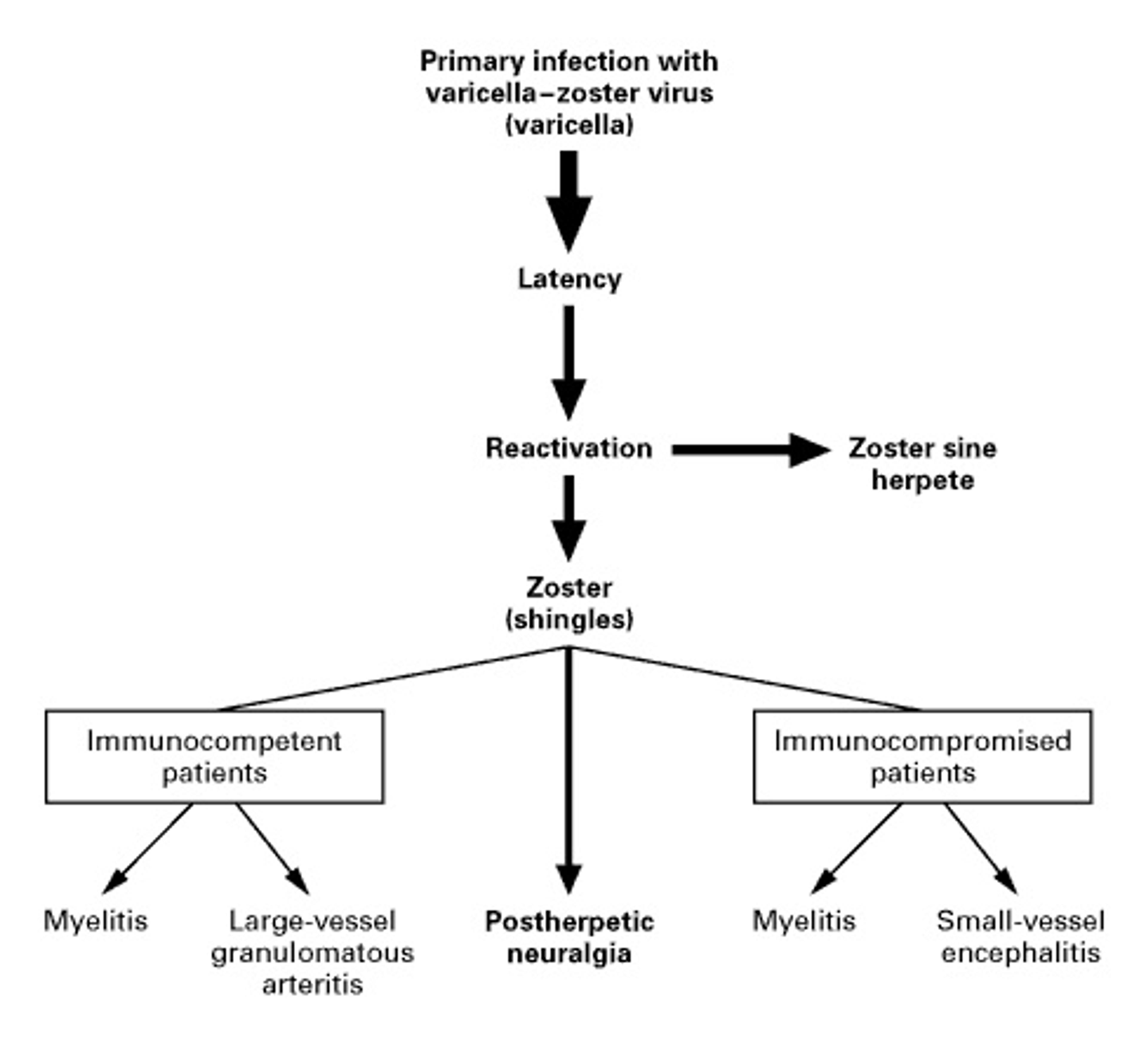 Neurologic Complications of the Reactivation of Varicella–Zoster Virus.