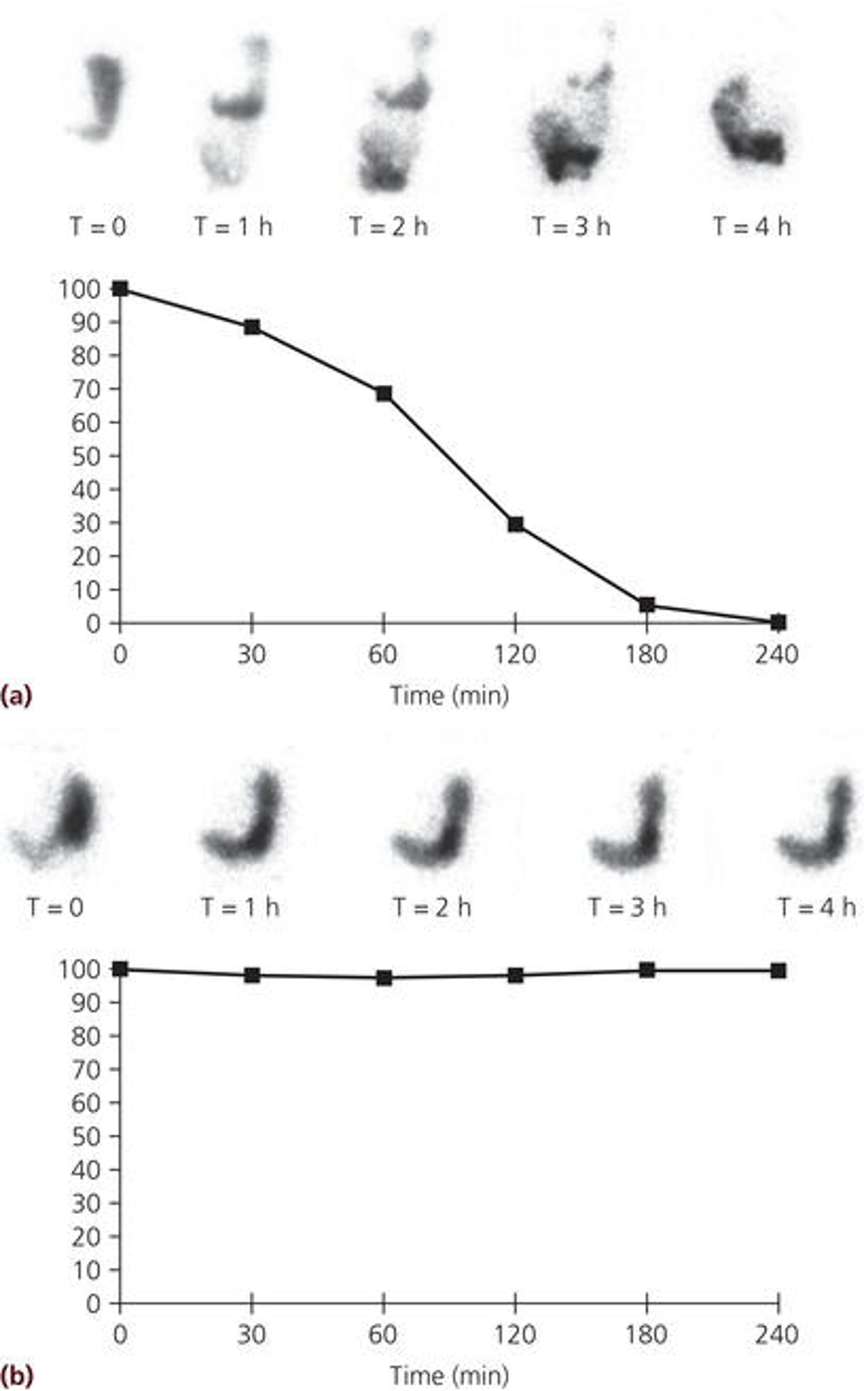 Gastric emptying scintigraphy using a technetium‐99m‐labeled egg sandwich meal which is ingested by the patient followed by imaging of the counts in the stomach over time. The percentages of gastric retention are shown for 0, 30, 60, 120, 180, and 240 min after meal ingestion. (a) Normal gastric emptying with only 30% retention at 2 h after meal ingestion (normal <60%) and complete emptying at 4 h (normal <10%). (b) Markedly delayed gastric emptying with little emptying at 4 h. Source: Courtesy of HP Parkman.