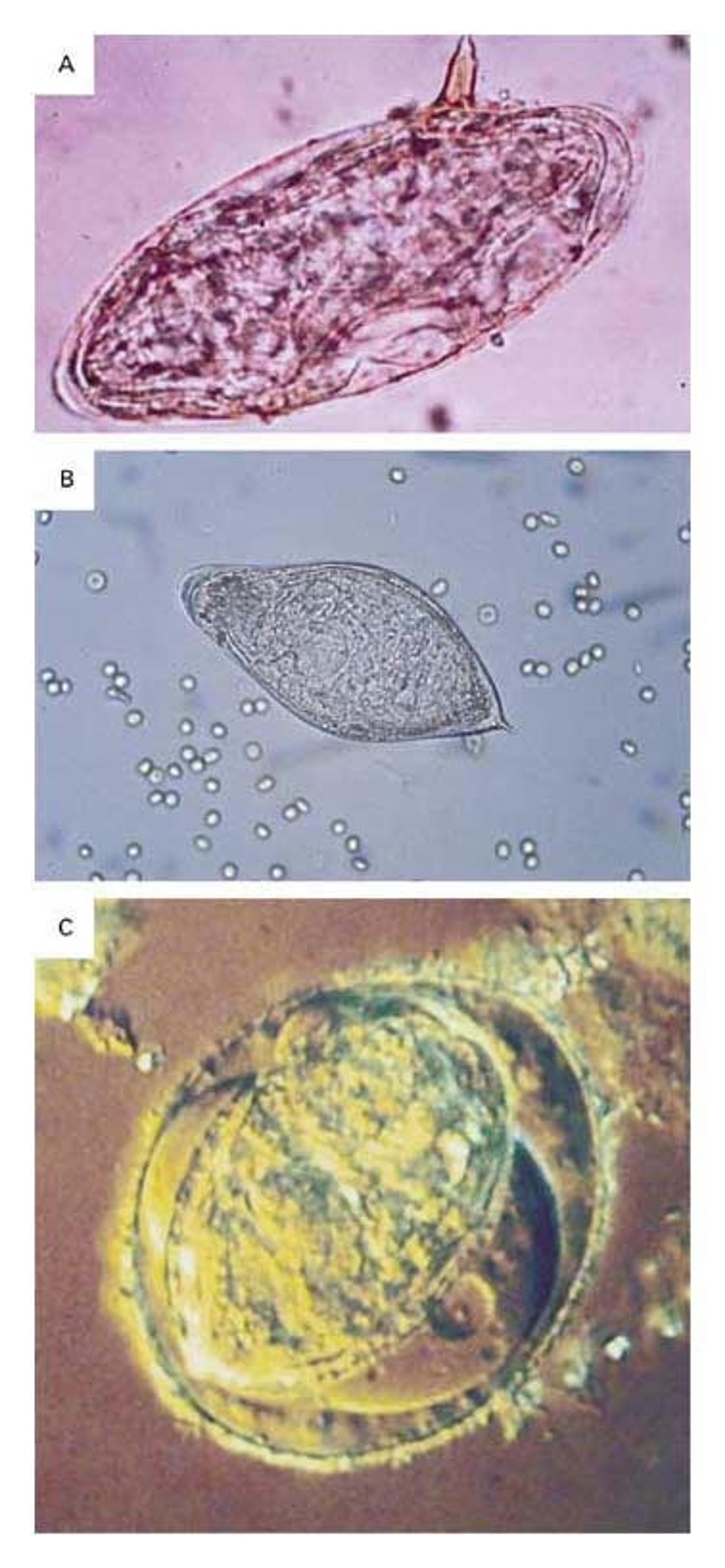 Morphology of the Eggs of the Three Key Schistosomes That Infect Humans.