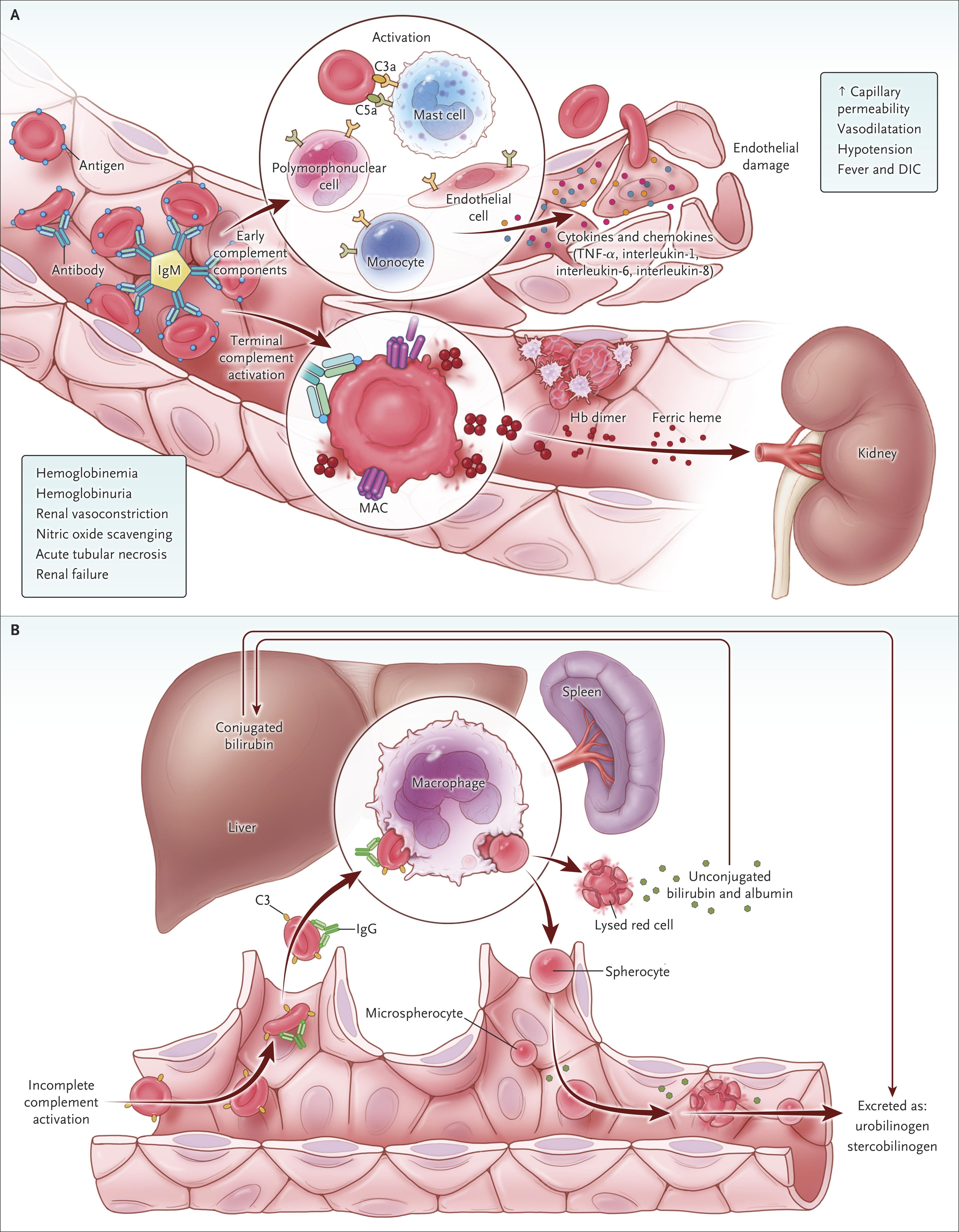 Pathophysiological Features of Acute and Delayed Hemolytic Transfusion Reactions.