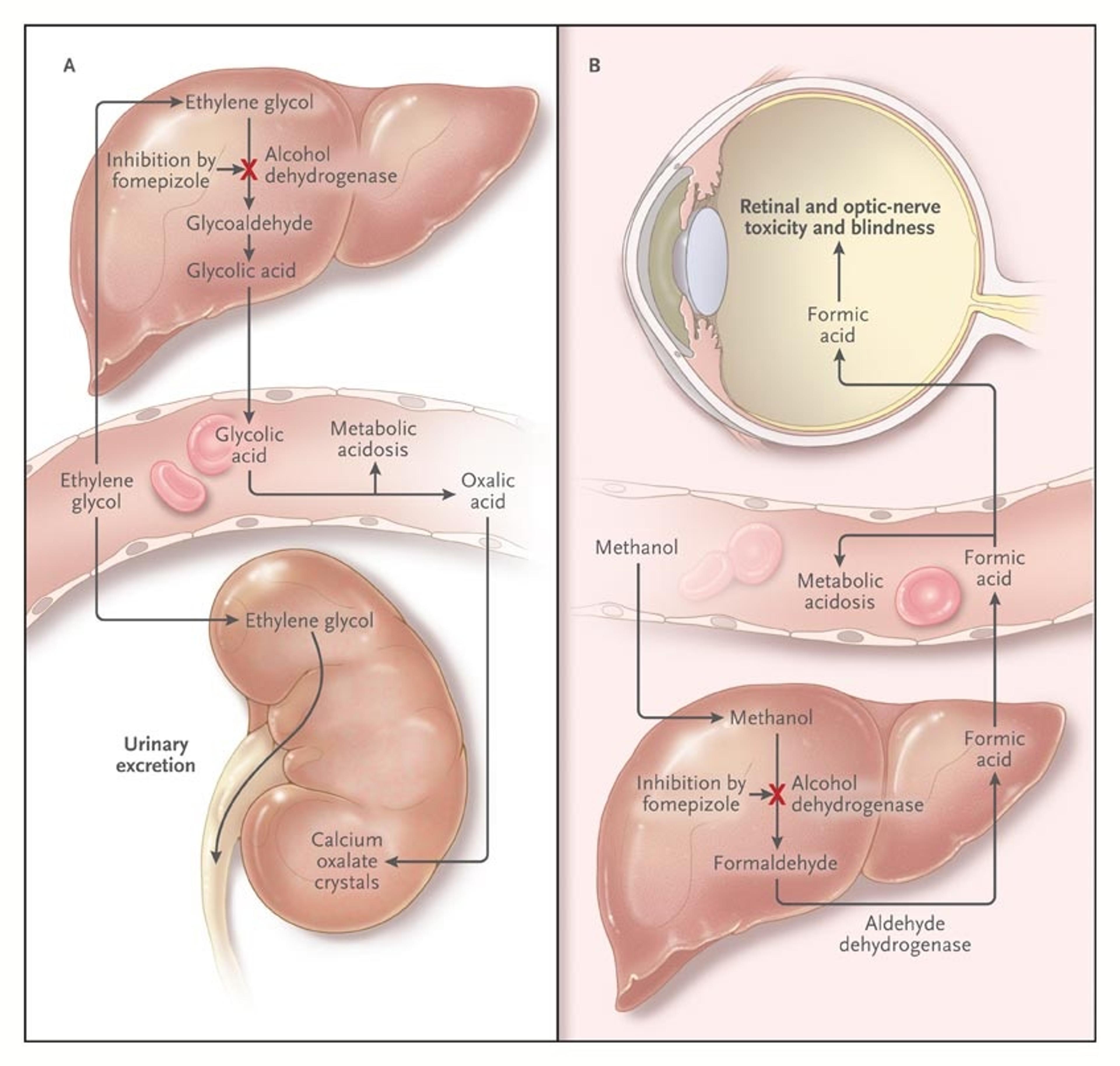 Effect of Fomepizole on the Pathophysiological Effects of Poisoning from Ethylene Glycol and Methanol.