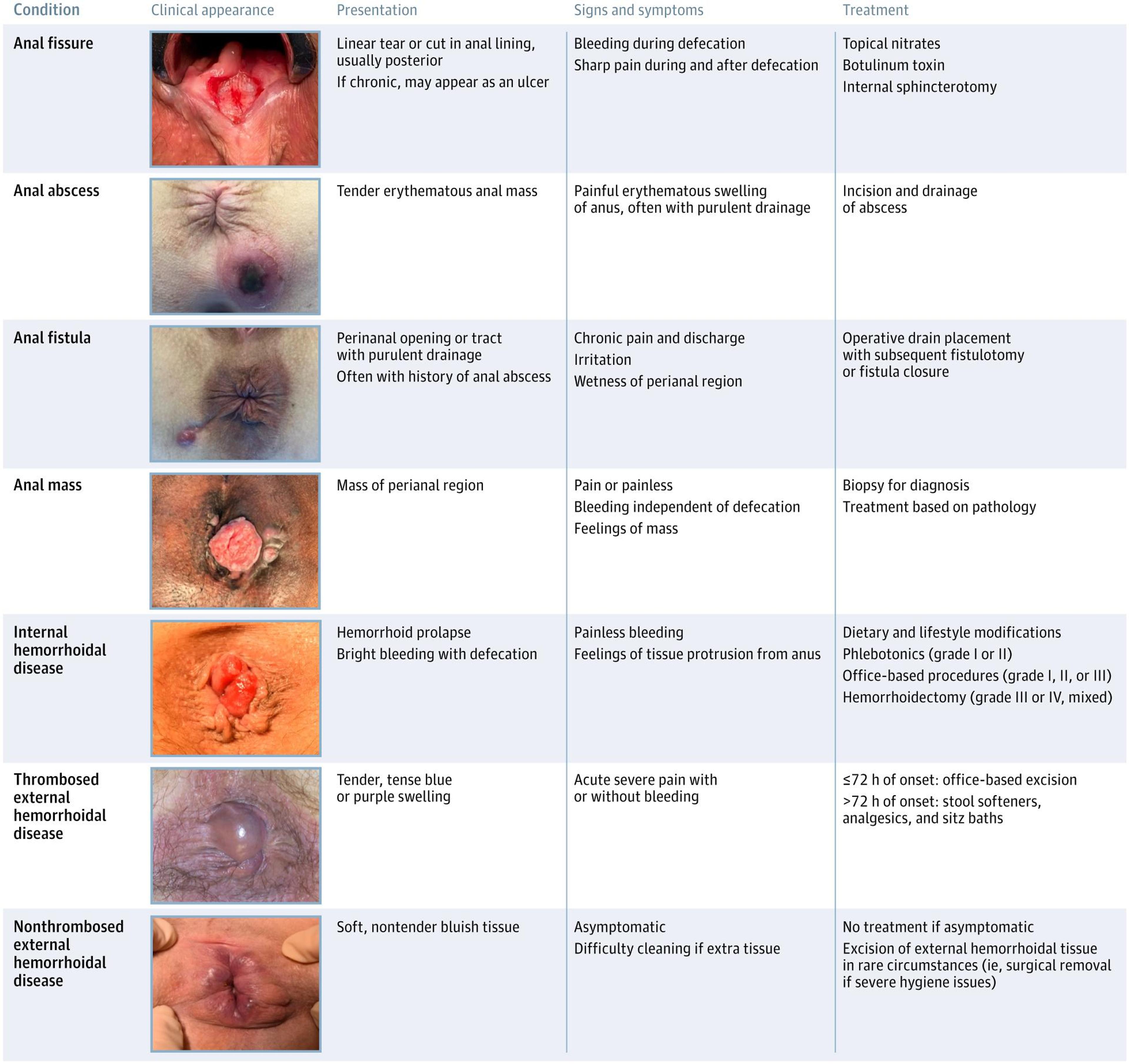 Conditions Commonly Mistaken for Hemorrhoidal Disease