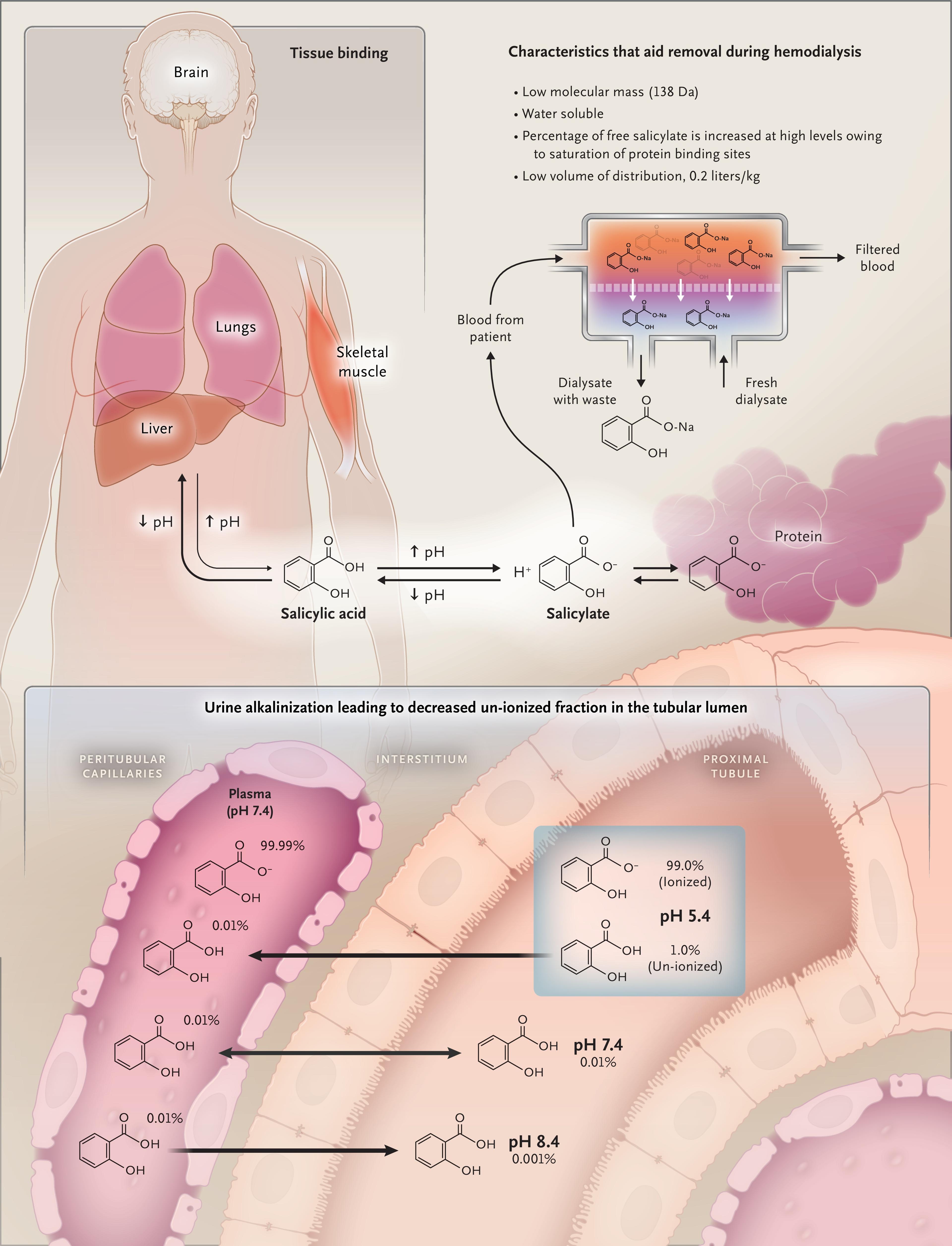 Therapeutic Strategies to Remove Salicylate from the Body.