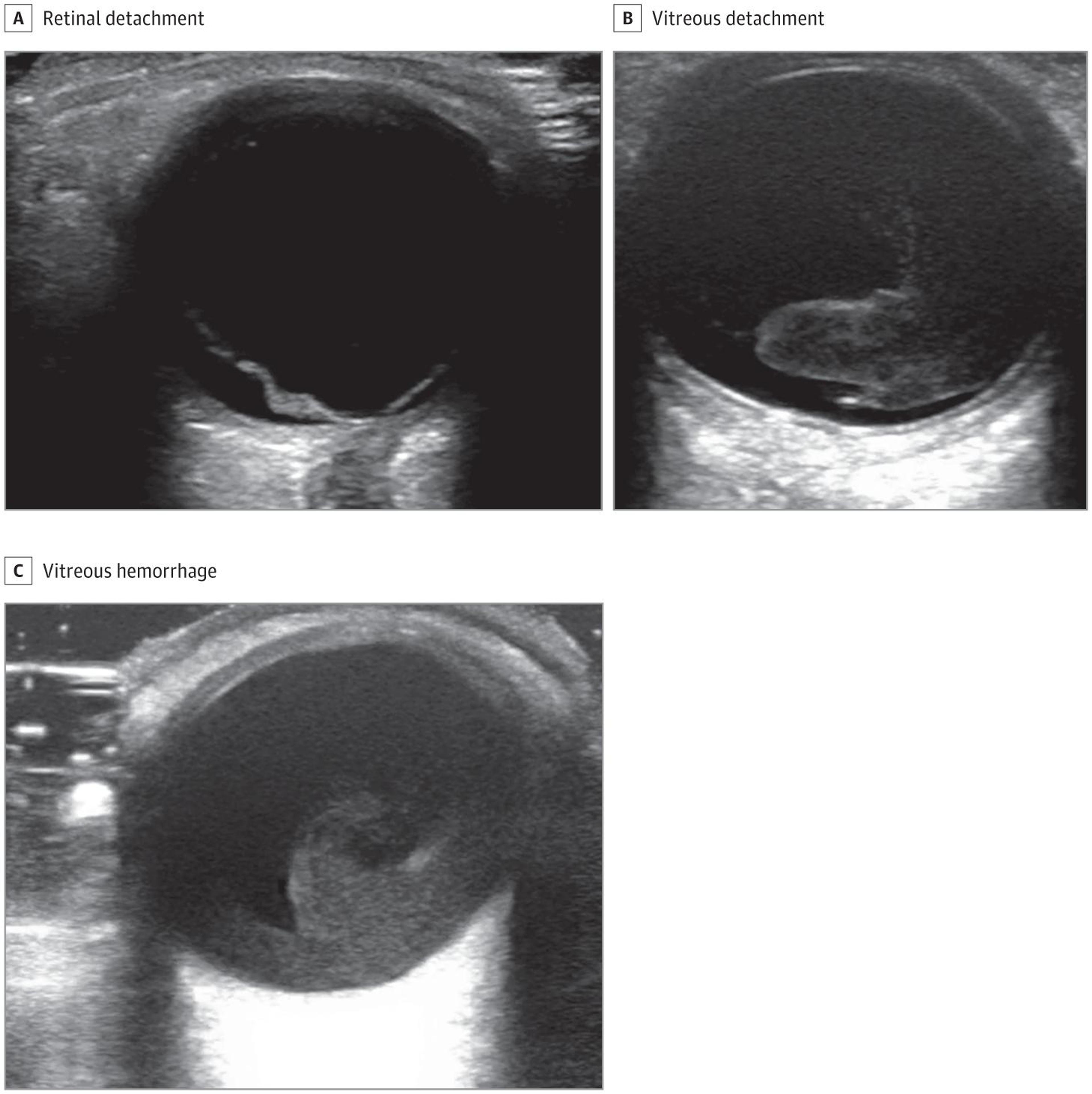 Point-of-Care Ultrasonographic Images