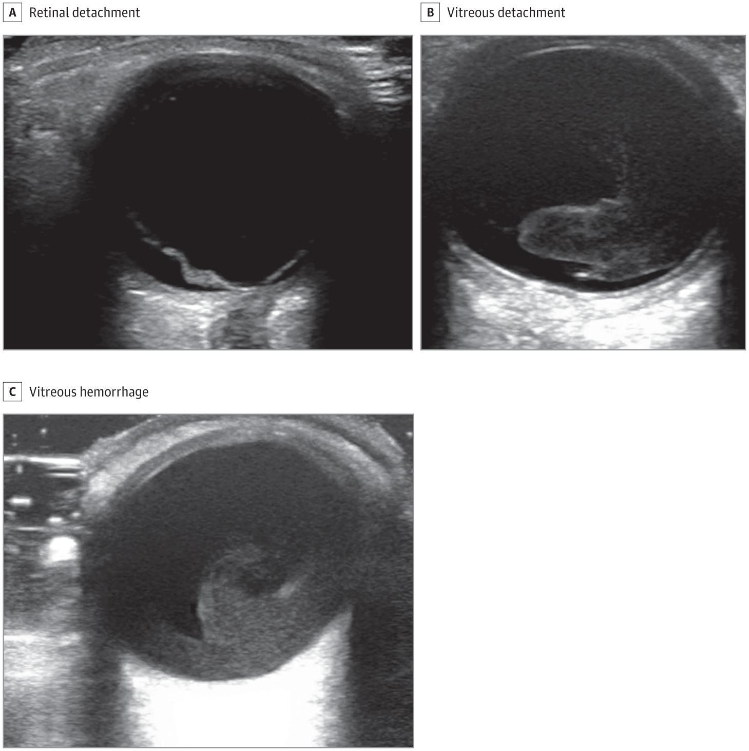 Point-of-Care Ultrasonographic Images