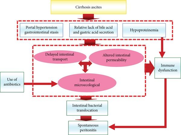 The pathogenesis of spontaneous peritonitis.