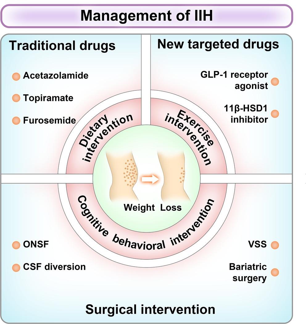 Management of IIH.