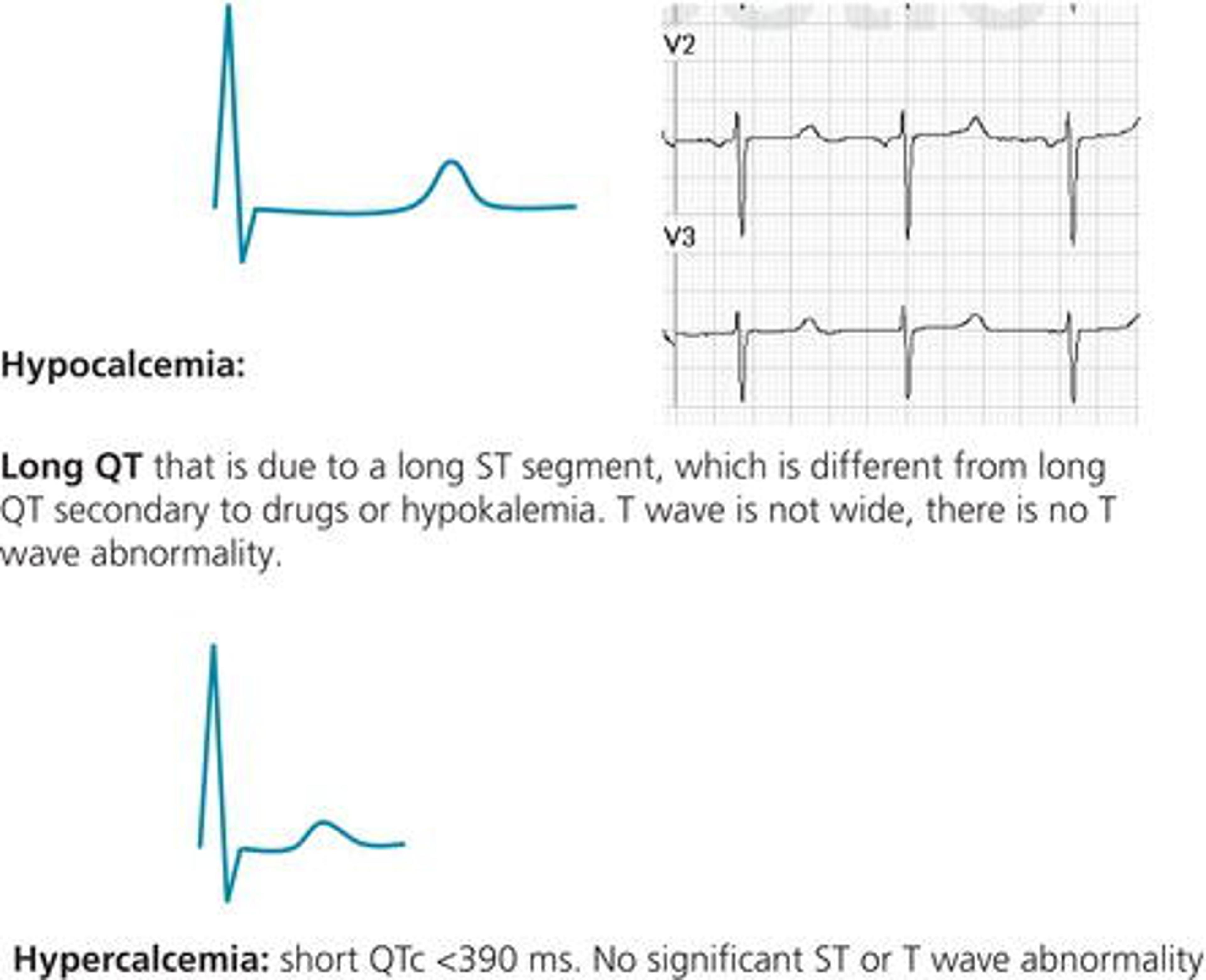 Figure 70. Hypocalcemia and hypercalcemia.