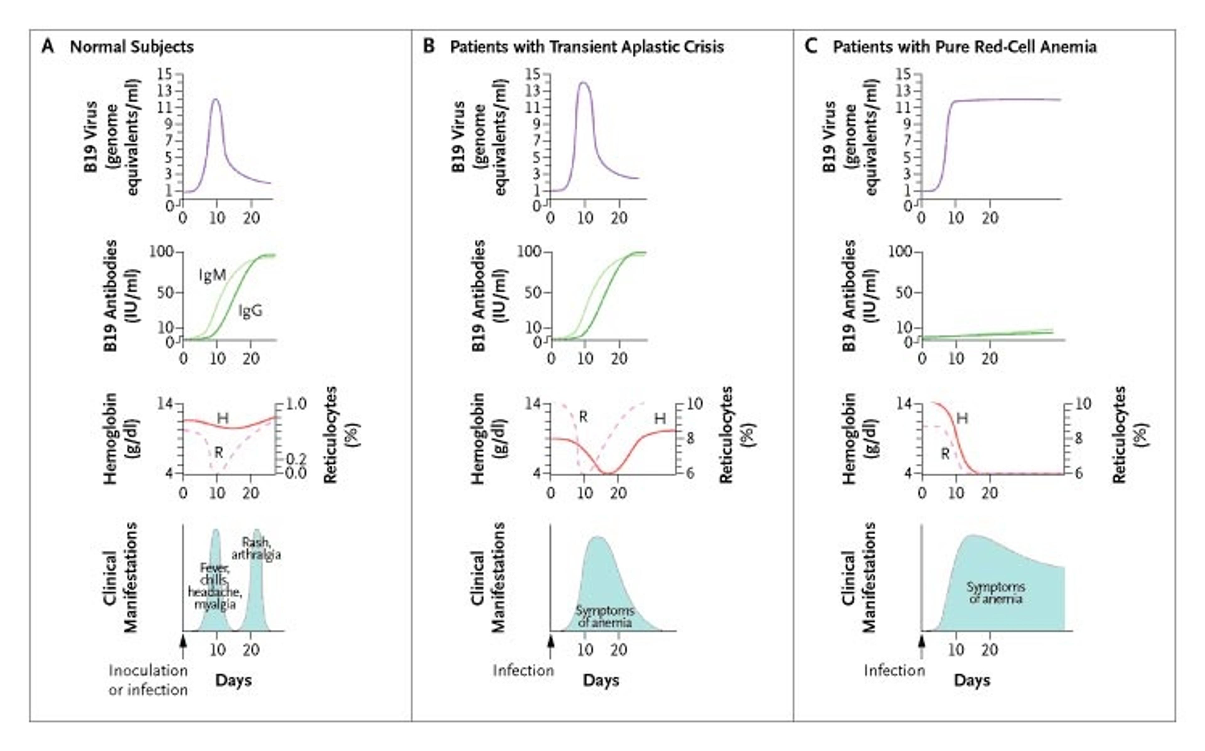Pathophysiology of Parvovirus B19 Infection.
