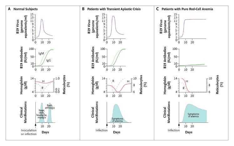 Pathophysiology of Parvovirus B19 Infection.