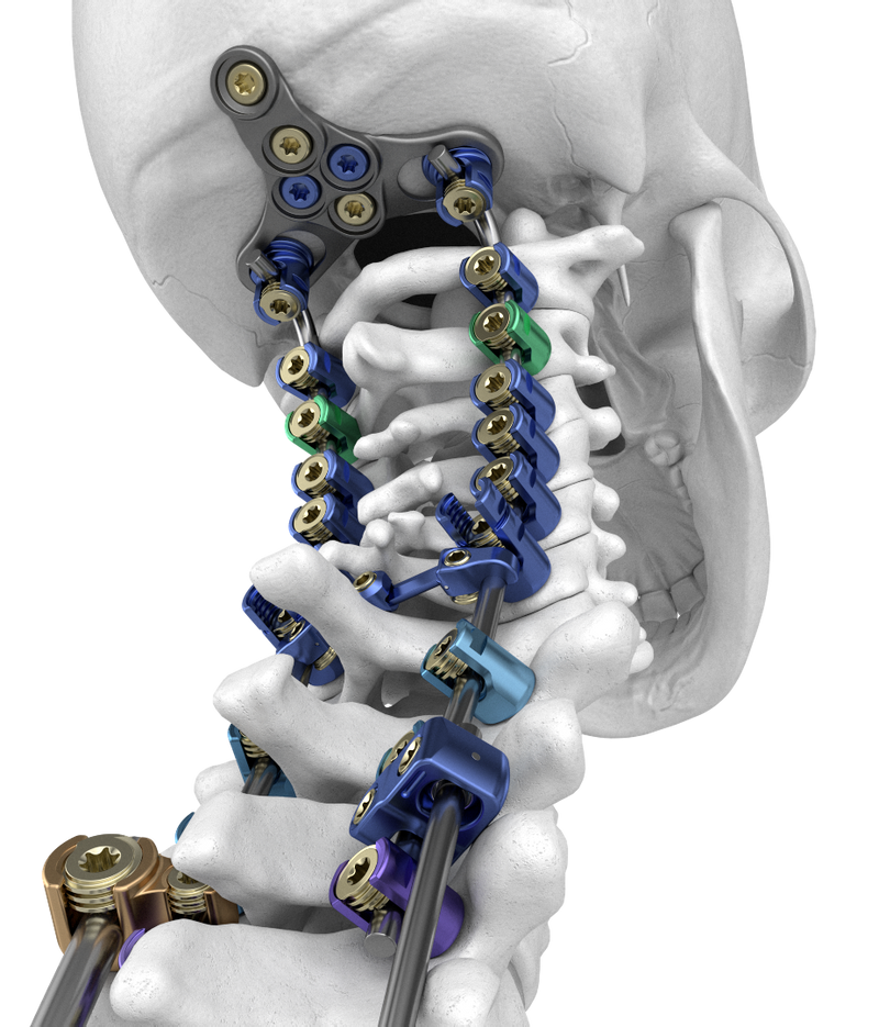 Transformative Solutions at Every Level