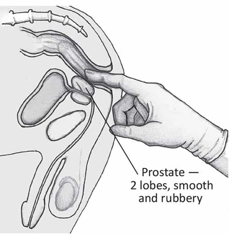 Здесь изображено схематическое строение мужского организма. Стрелкой указано расположение простаты, которая по форме напомниает орешек.