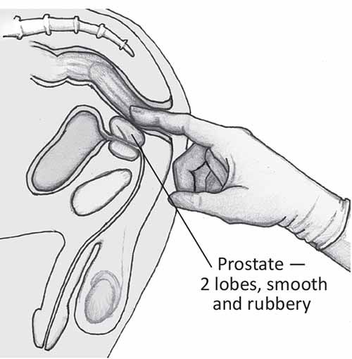 Здесь изображено схематическое строение мужского организма. Стрелкой указано расположение простаты, которая по форме напомниает орешек.